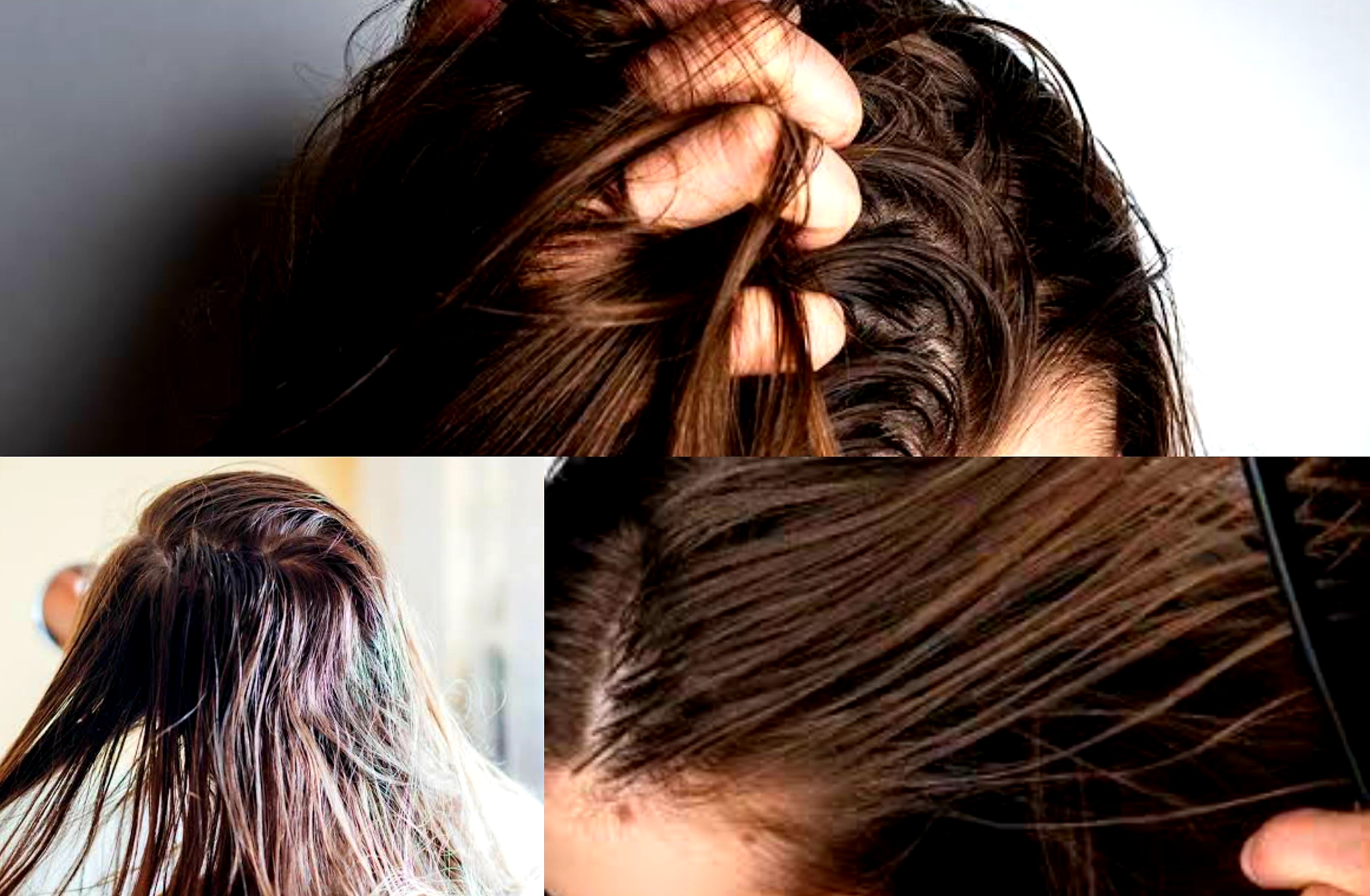 Bikin Ngga Percaya Diri? Begini Cara Ampuh Atasi Rambut Lepek Berminyak!