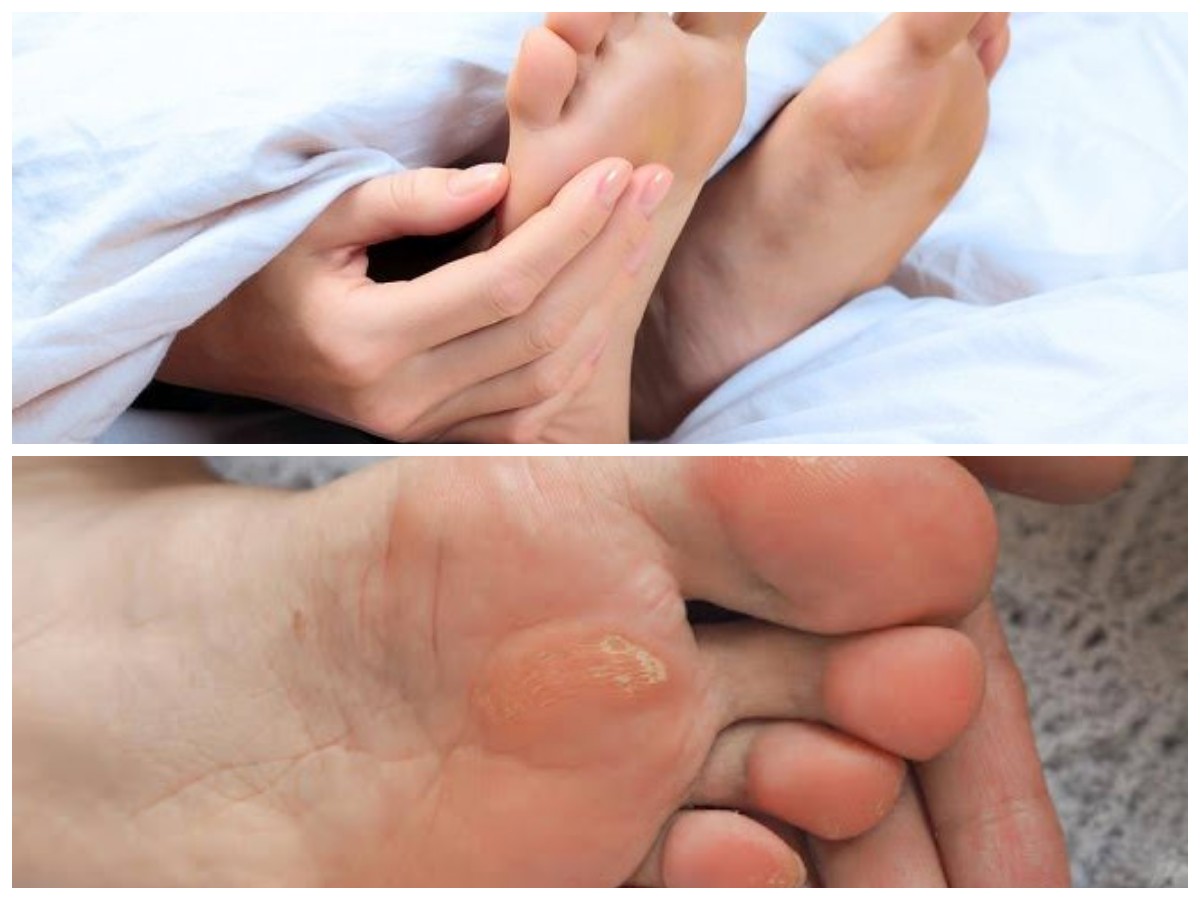 Telapak Kaki Gatal Tiba-Tiba? Kenali Penyebab Umumnya dan Tips Ampuh untuk Mengatasinya!