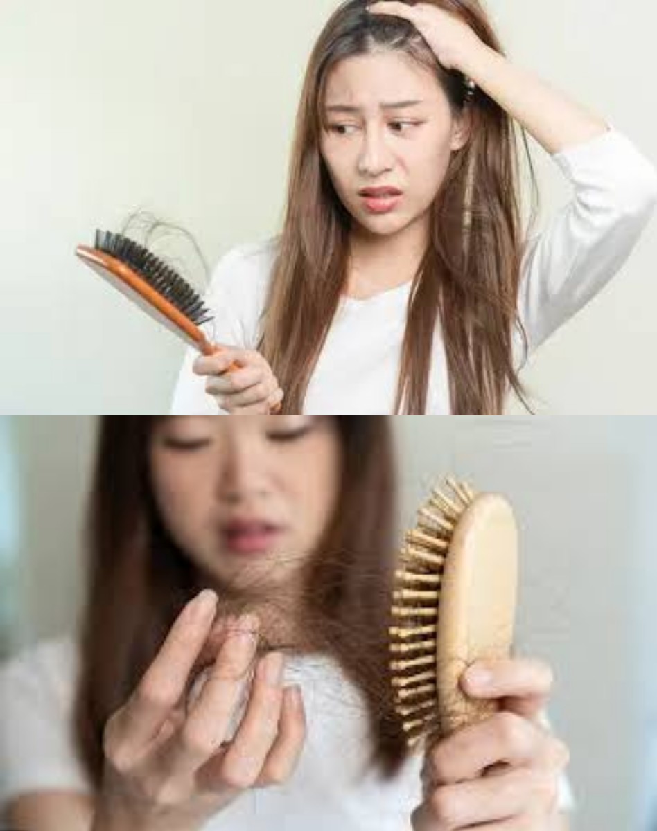 Rambut Rontok Tiap Sisiran Salah Shampoo atau Salah Pola Makan