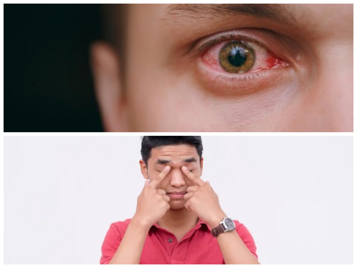 Mata Tiba-Tiba Buram? Ini Penyebab Umumnya dan Cara Mengatasinya dengan Tepat!