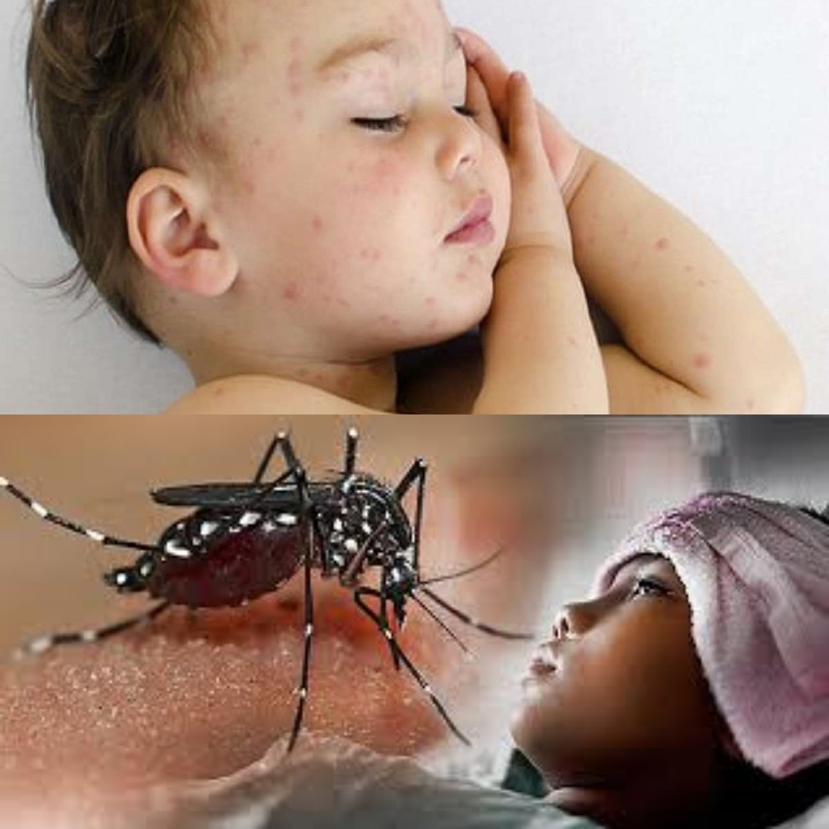  7 Gejala DBD dan Cara Mencegahnya Yang Harus Diketahui!