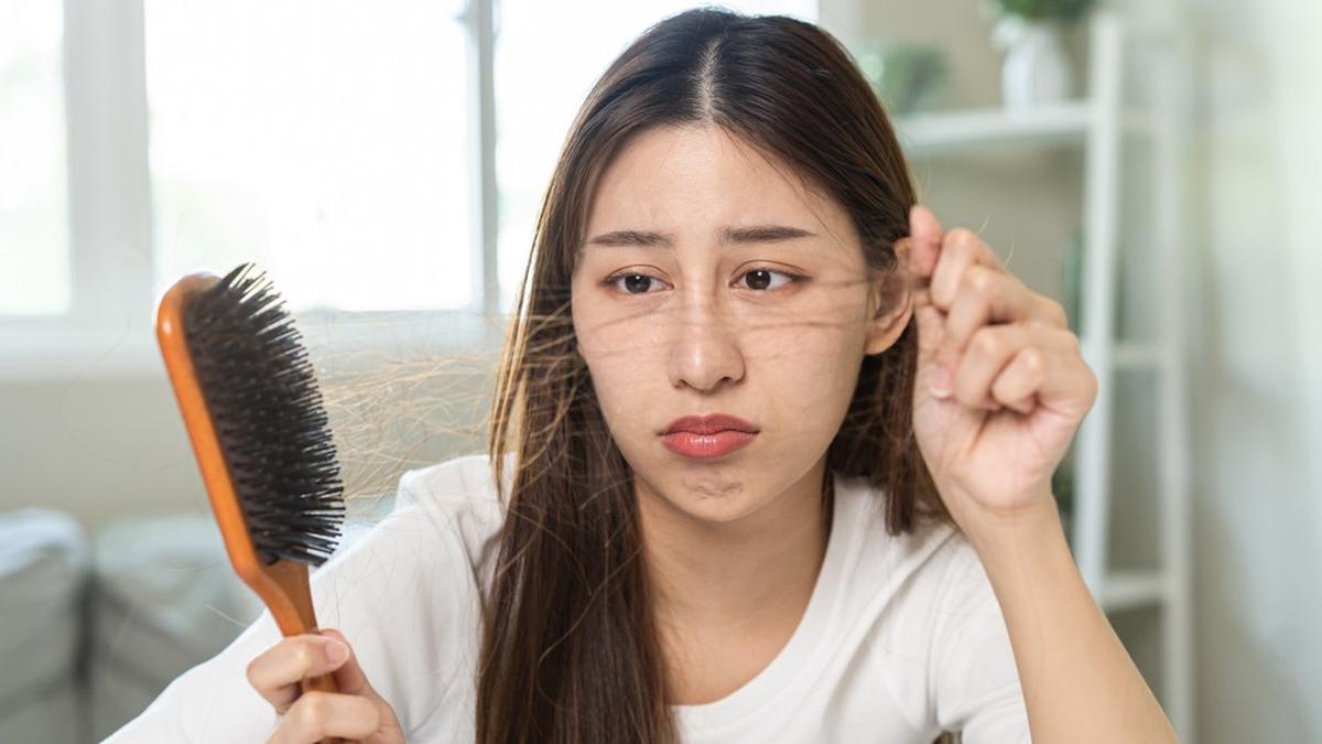 Kamu Harus Catat Ini,  5 Cara Alami Mengatasi Rambut Rontok Yang Paling Ampuh 