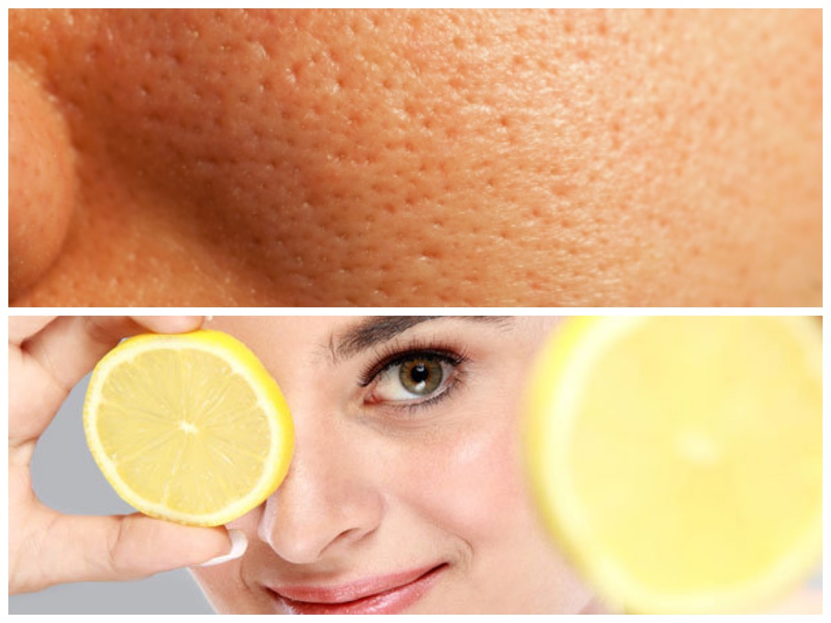 Cara Efektif Mengecilkan Pori-Pori Besar dan Mendapatkan Kulit Wajah Sempurna