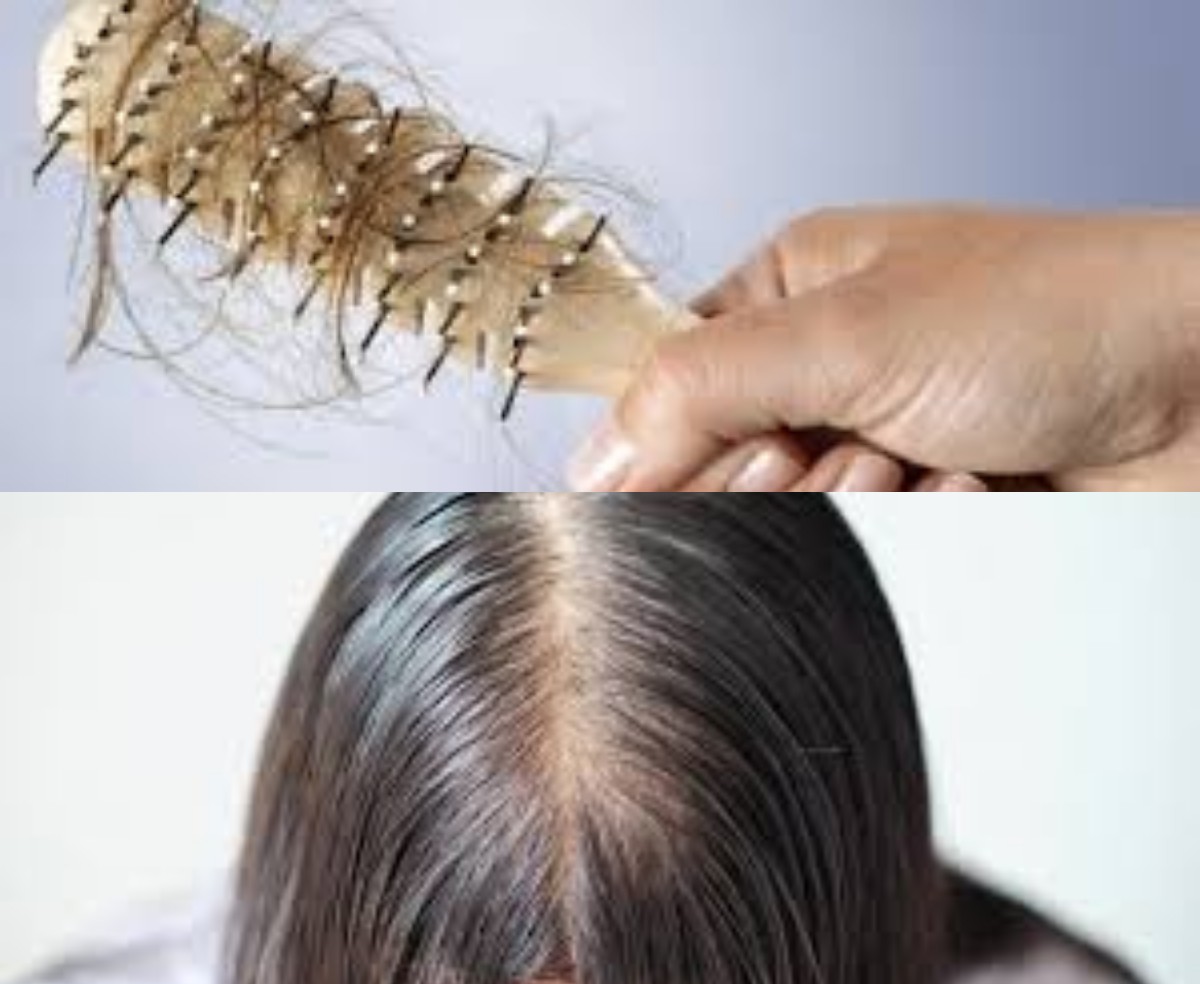 Rambut Anda Rontok dan Menipis? Mungkin Ini Penyebabnya