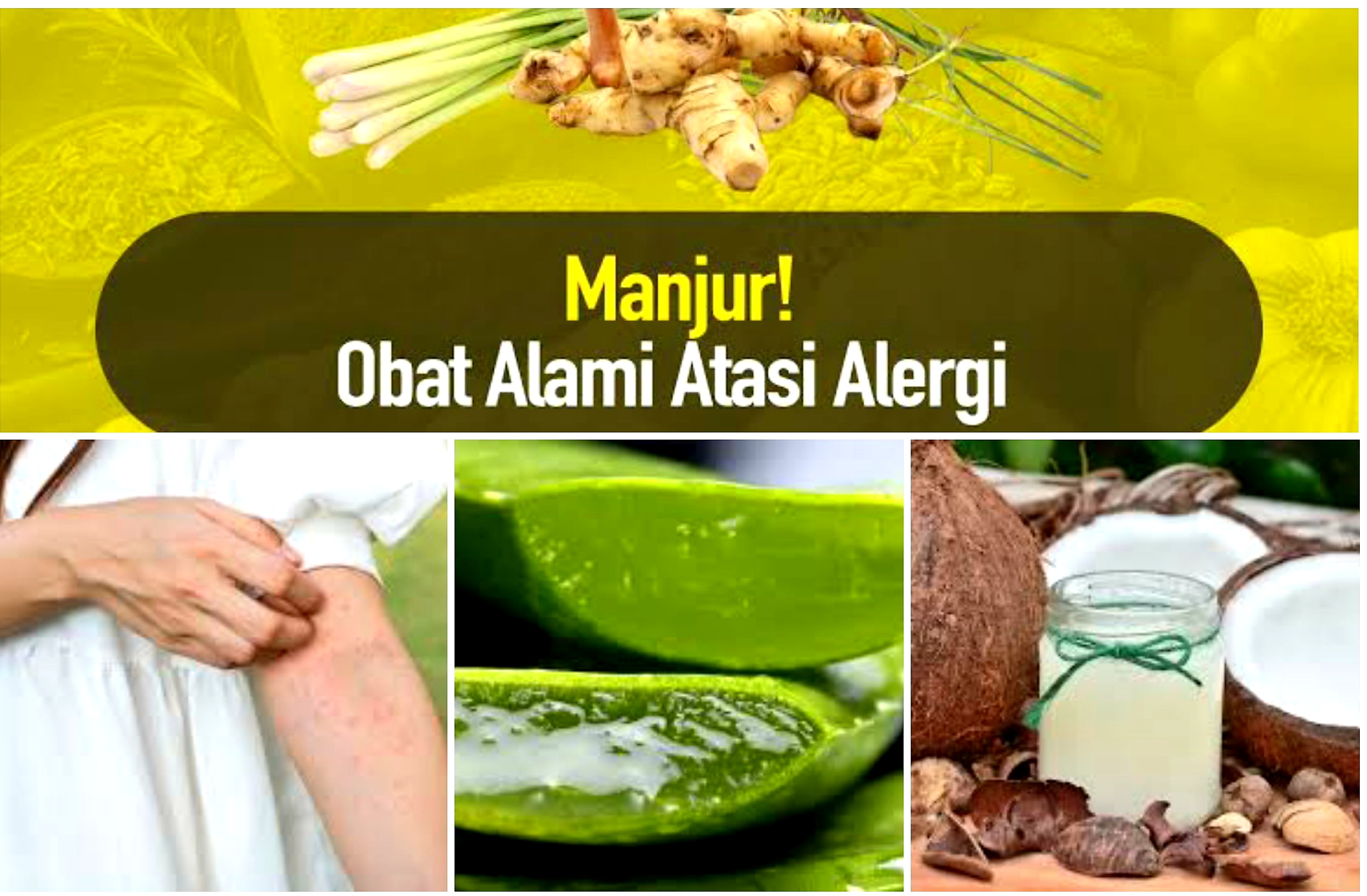 Harus Tahu! Ini Obat Alami Saat Terkena Alergi