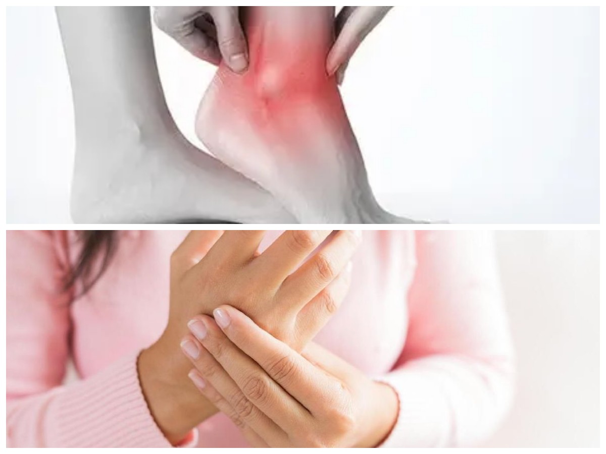 Waspadai Gejalanya! Ini Ciri-Ciri Asam Urat, Penyebab, dan Cara Mengatasinya Secara Alami