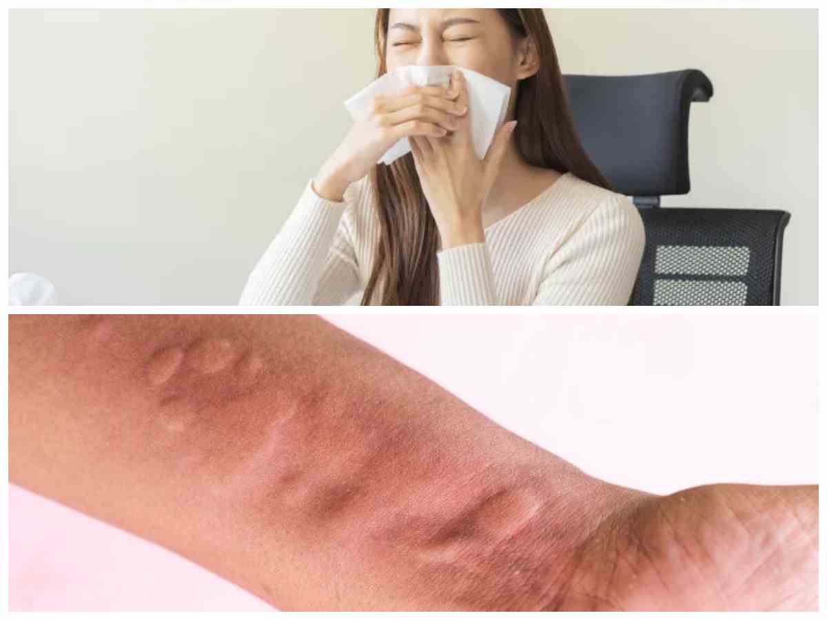 Tips Ampuh Atasi Alergi Dingin dan Debu, Yuk Dicoba!