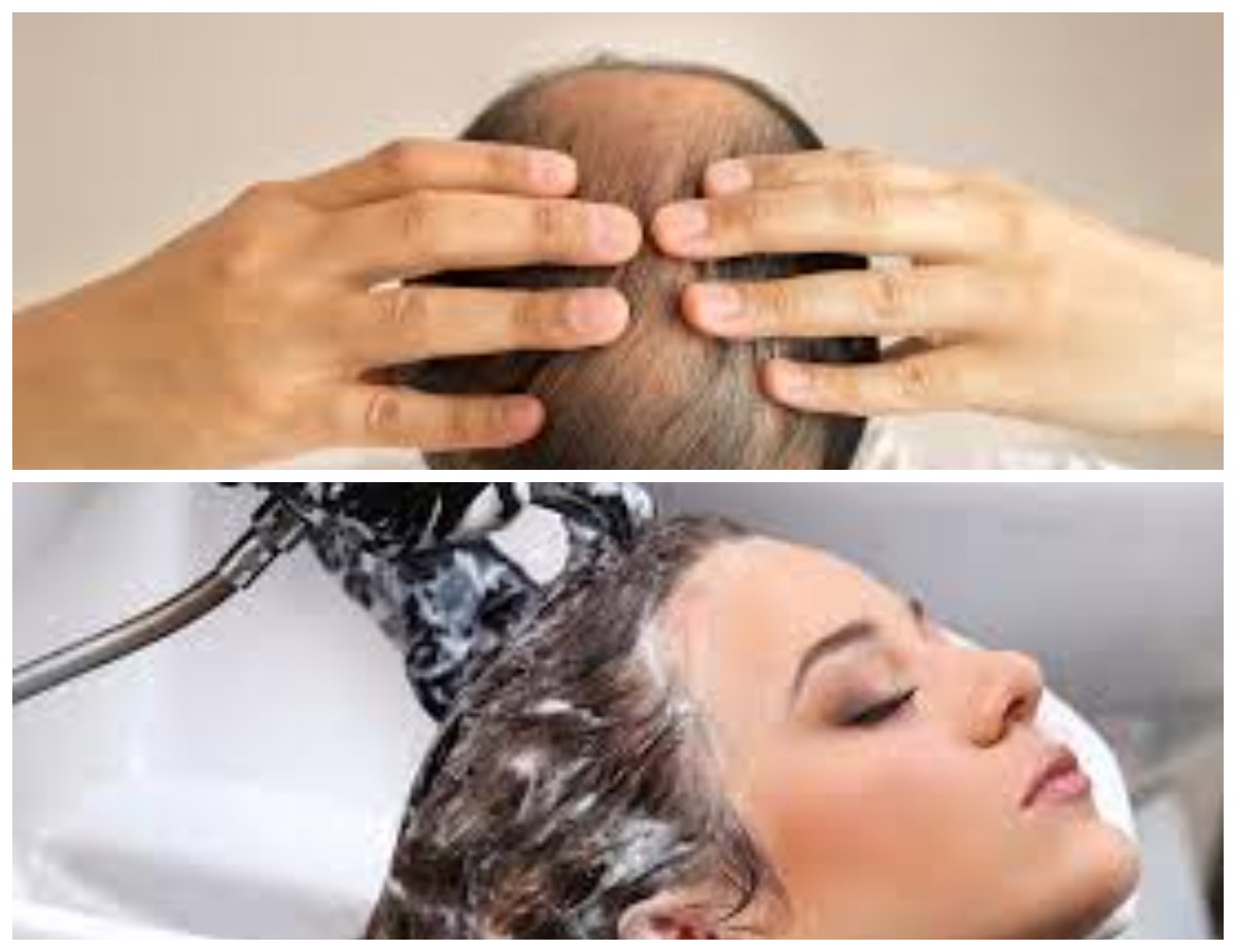 Tips Jitu: 7 Cara Meningkatkan Pertumbuhan Rambut dengan Cepat dan Alami