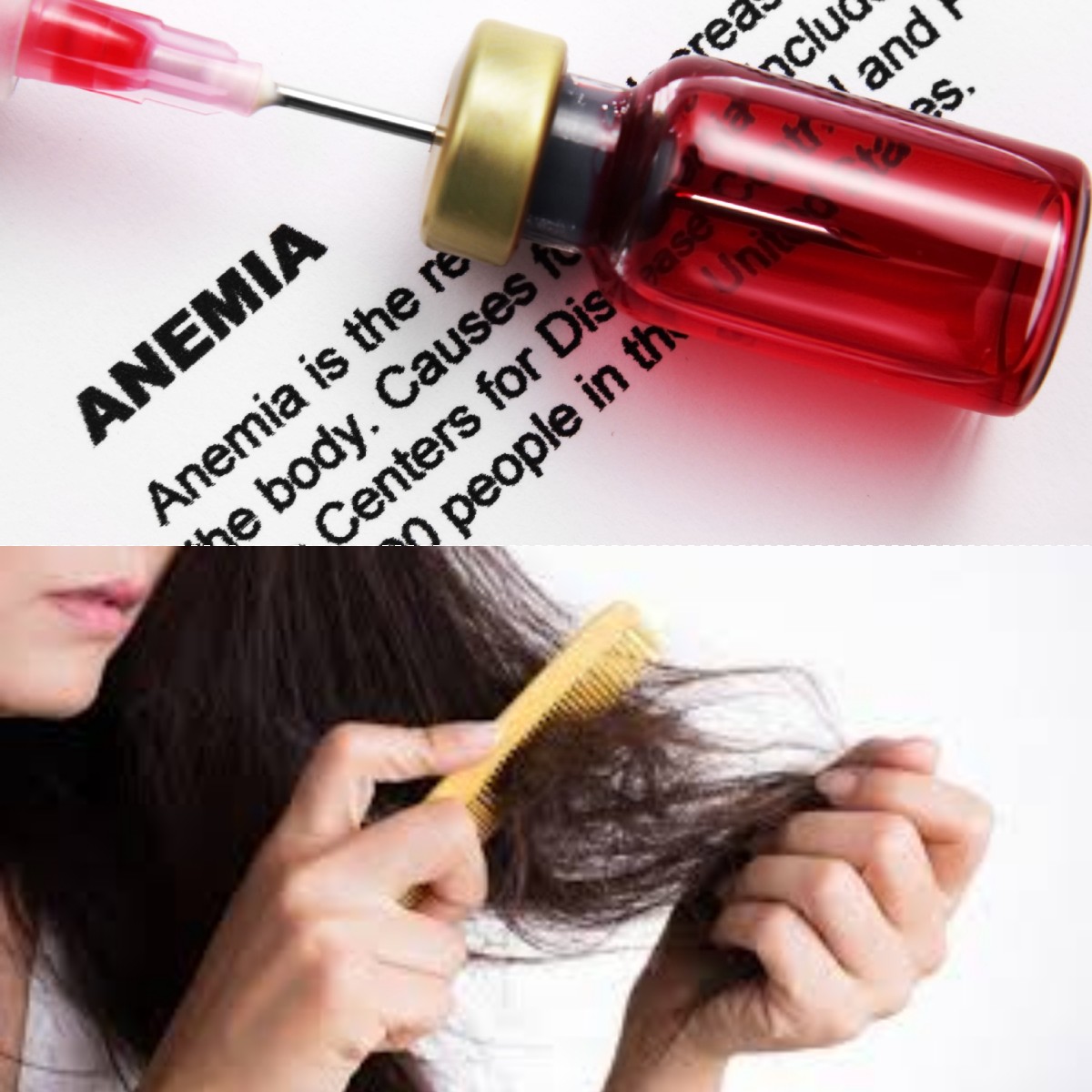 Anemia dan Rambut Rontok Ketika Kekurangan Zat Besi Terlihat dari Kepala Anda