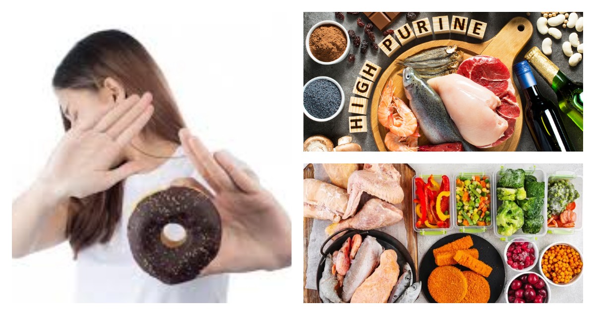 Dear Penderita Asam Urat, Ini Daftar Makanan yang Aman dan Harus Dihindari agar Kadar Urat Tetap Terkontrol