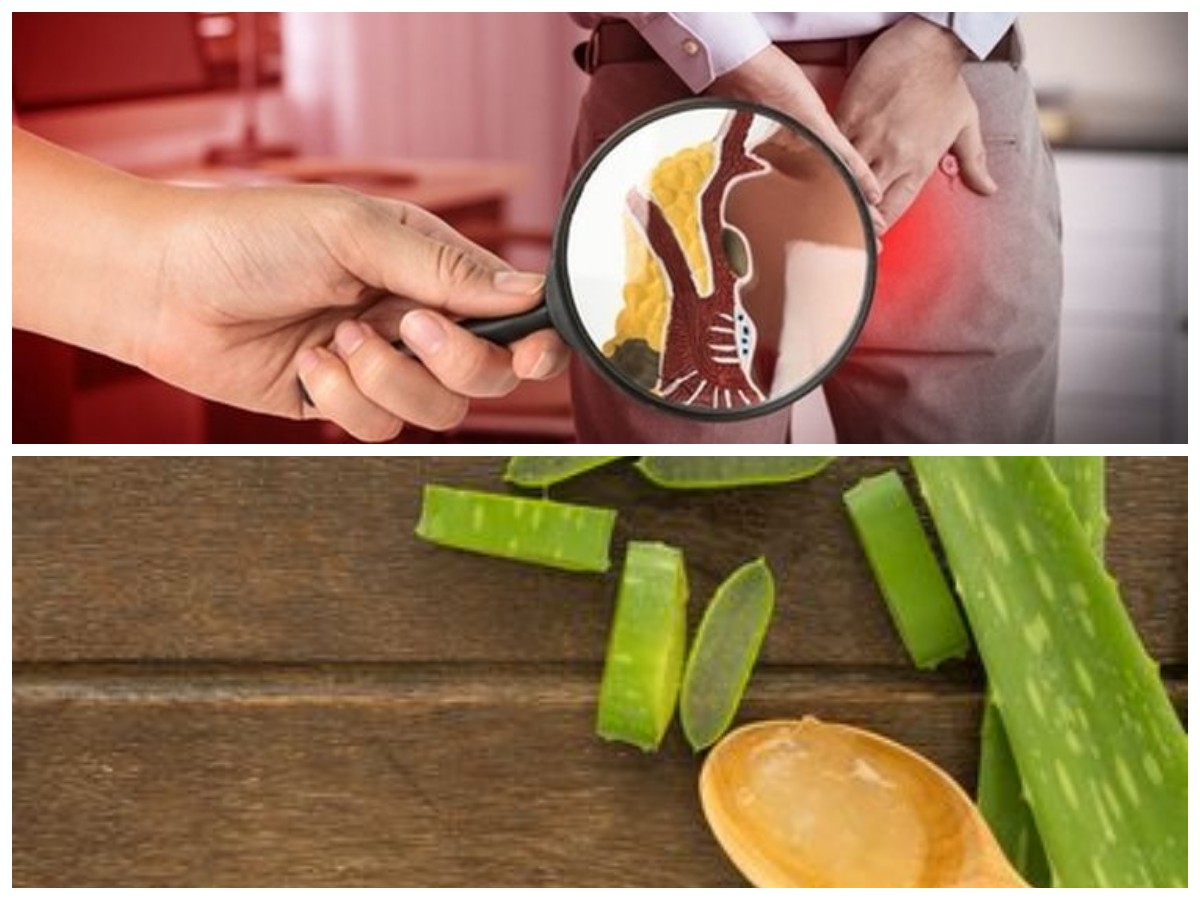 7 Cara Alami yang Efektif untuk Mengatasi Ambeien tanpa Obat Kimia