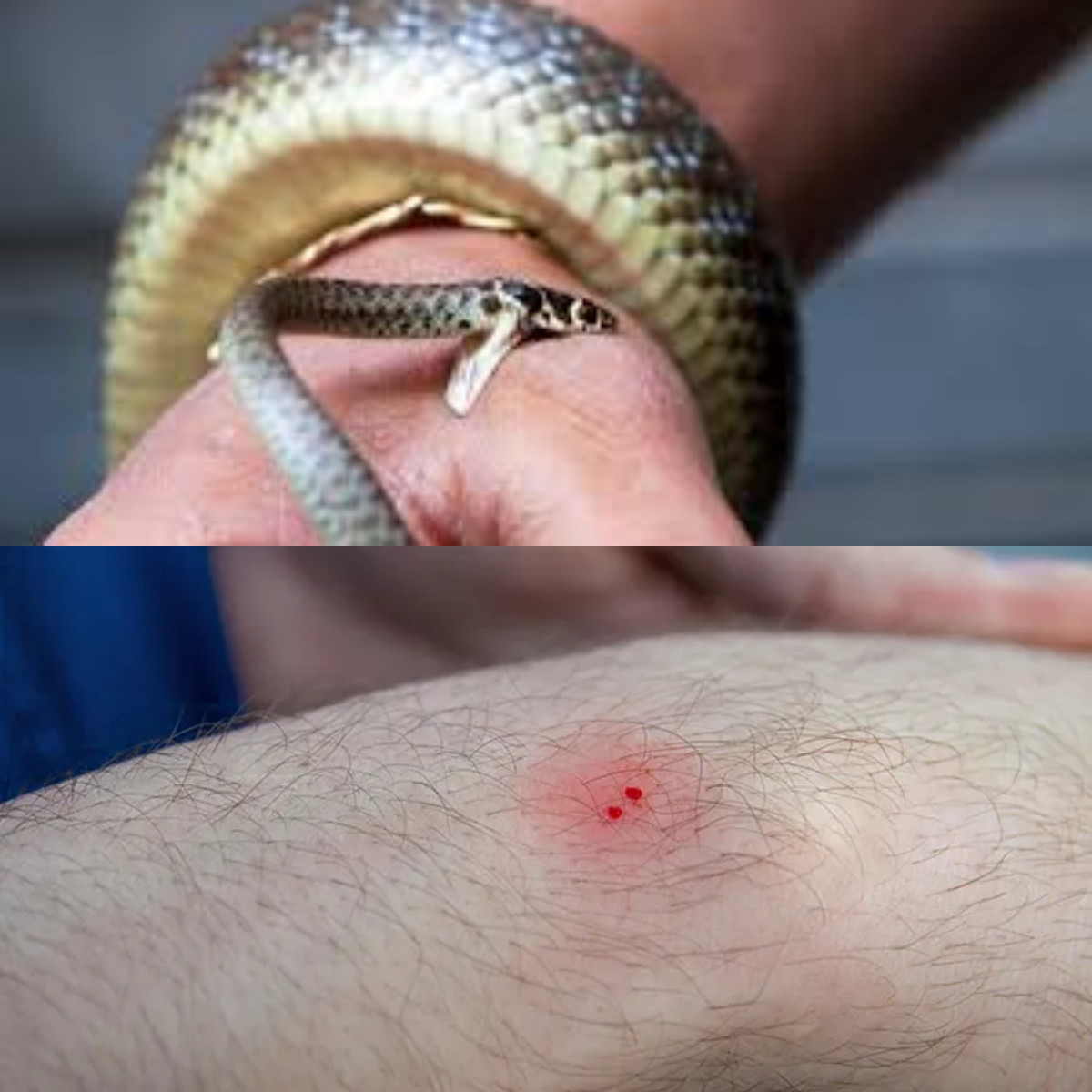 Digigit Ular, Tetap Tenang dan Laksanakan Langkah Ini!