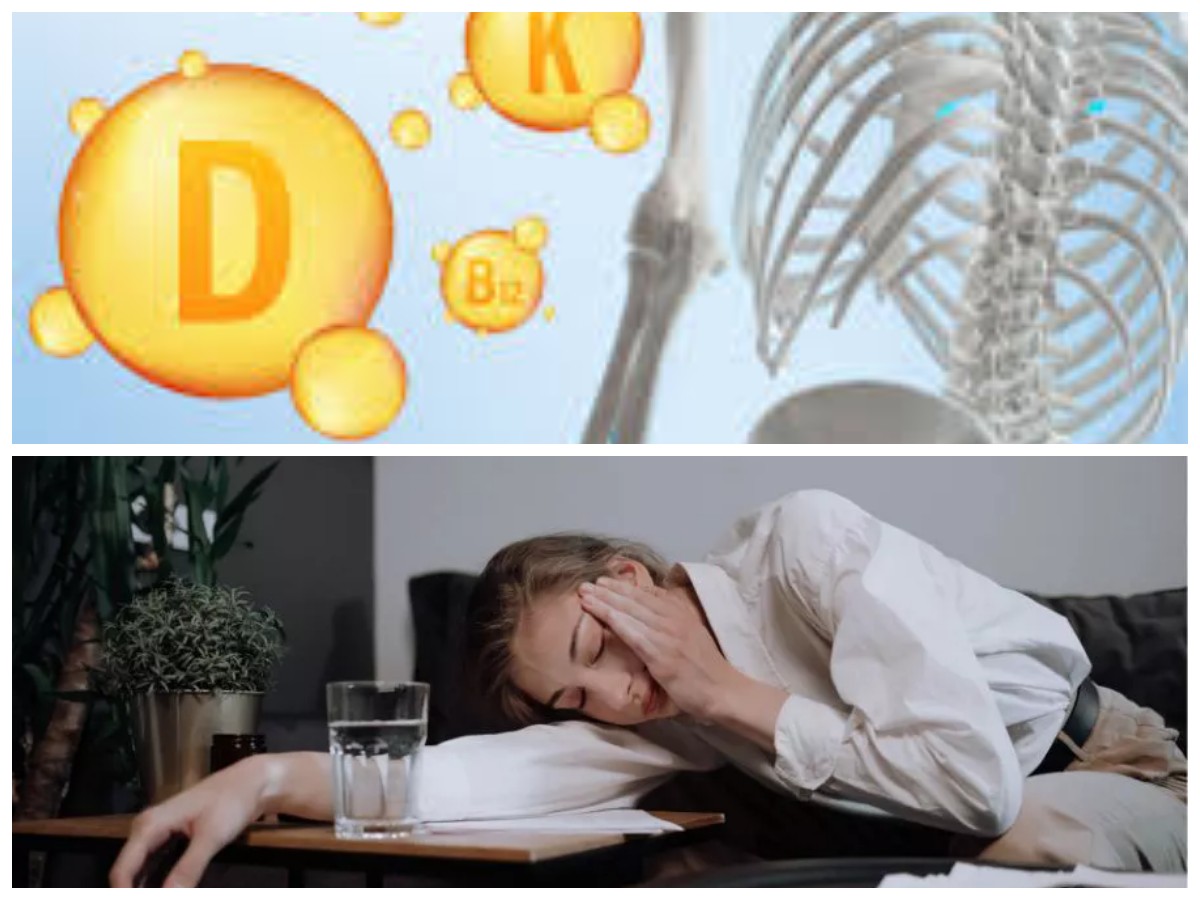 Kenali Gejala Kekurangan Vitamin D: Risiko, Dampak, dan Tips Menjaga Tulang Tetap Kuat