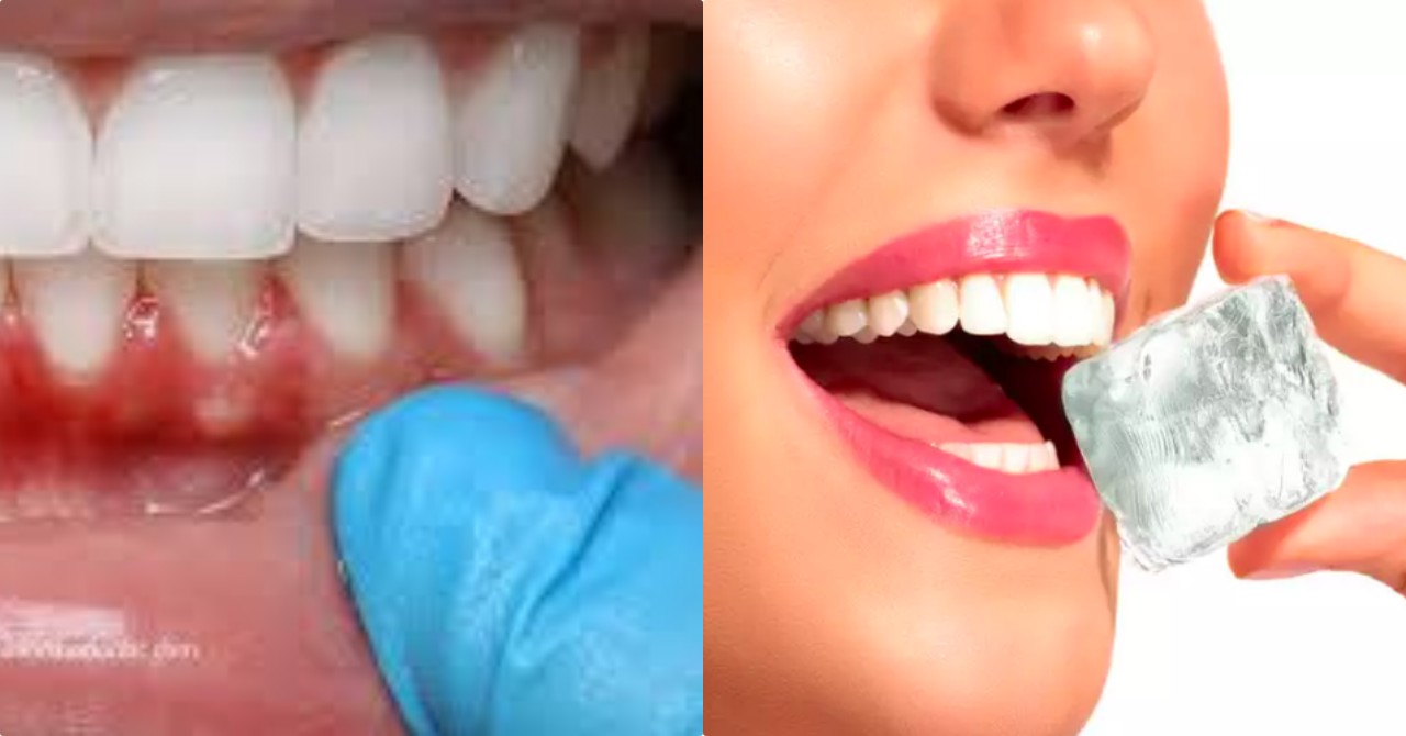 5 Faktor Penyebab Gusi Berdarah dan Solusinya