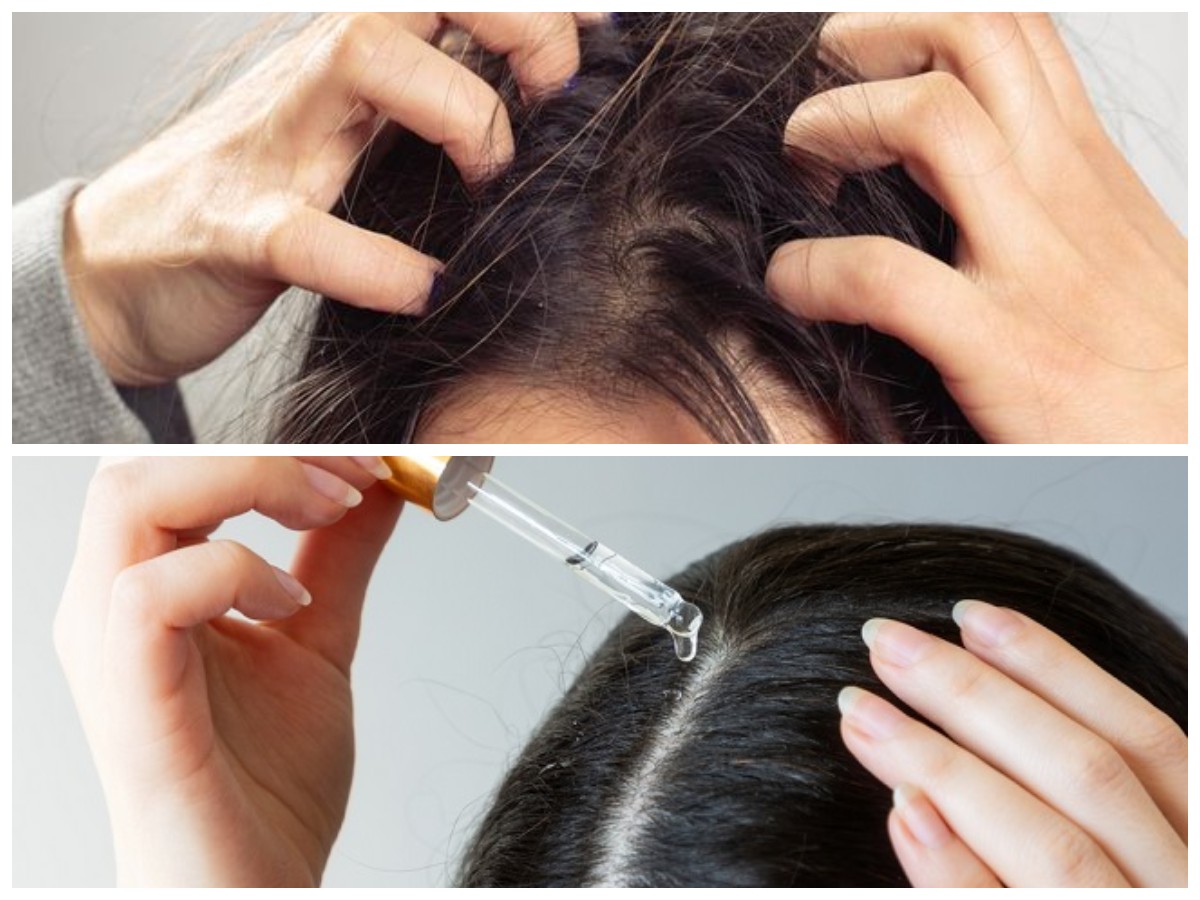  7 Cara Ampuh Menyuburkan Rambut dan Merawat Kulit Kepala