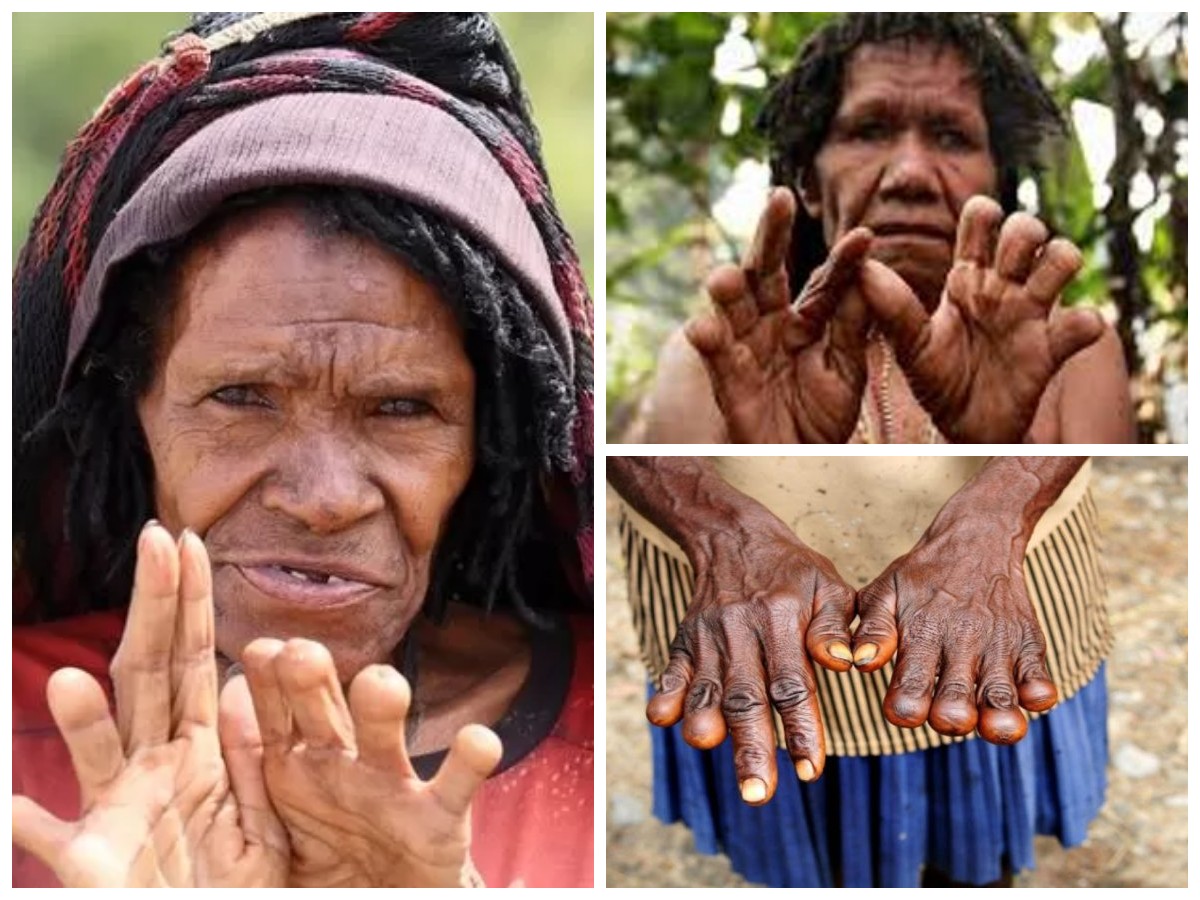 Sejarah Suku Dani dan Ritual Potong Jari: Tradisi, Makna, dan Perubahannya dalam Kehidupan Masyarakat Papua!