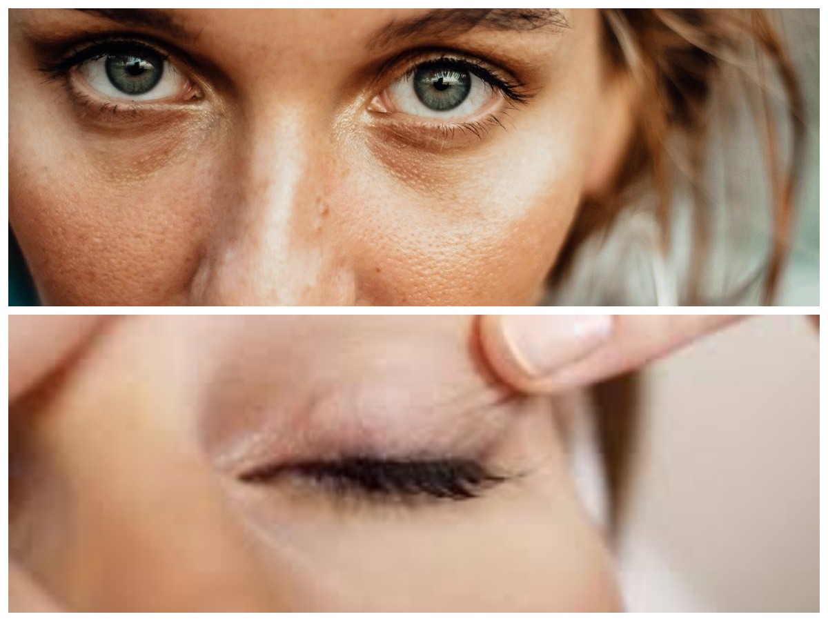 Mata Lelah dan Sayu? Kenali Penyebab dan Cara Mengatasinya