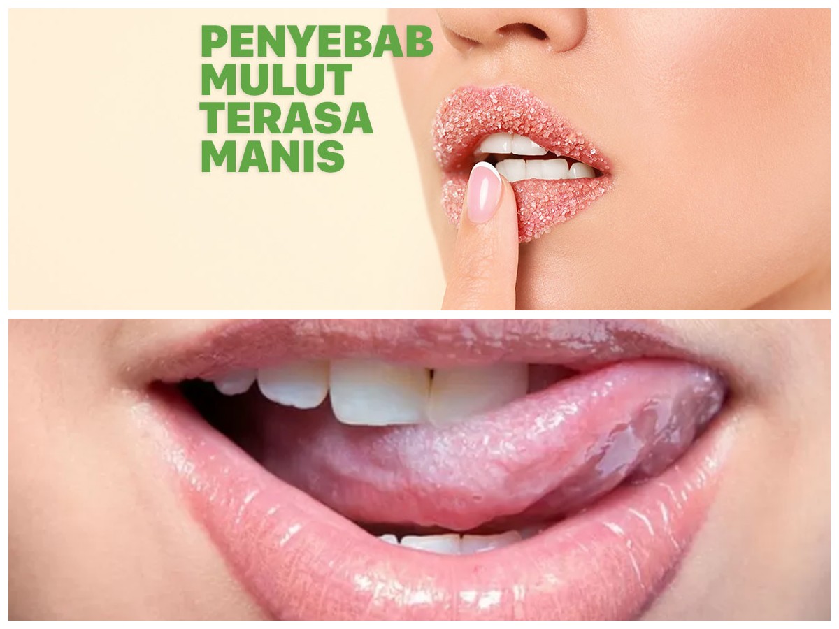 Mengapa Mulut Terasa Manis? Panduan Lengkap dari Penyebab hingga Cara Mengatasinya