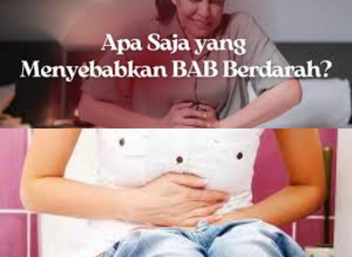 Waspada! Inilah Penyebab BAB Berdarah yang Perlu Diketahui Masyarakat