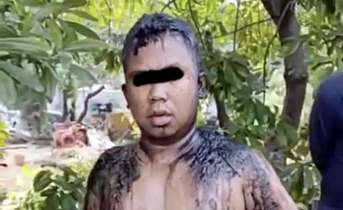 Seorang Pria Di Tanjung Priok Disiram Air Keras Oleh OTK