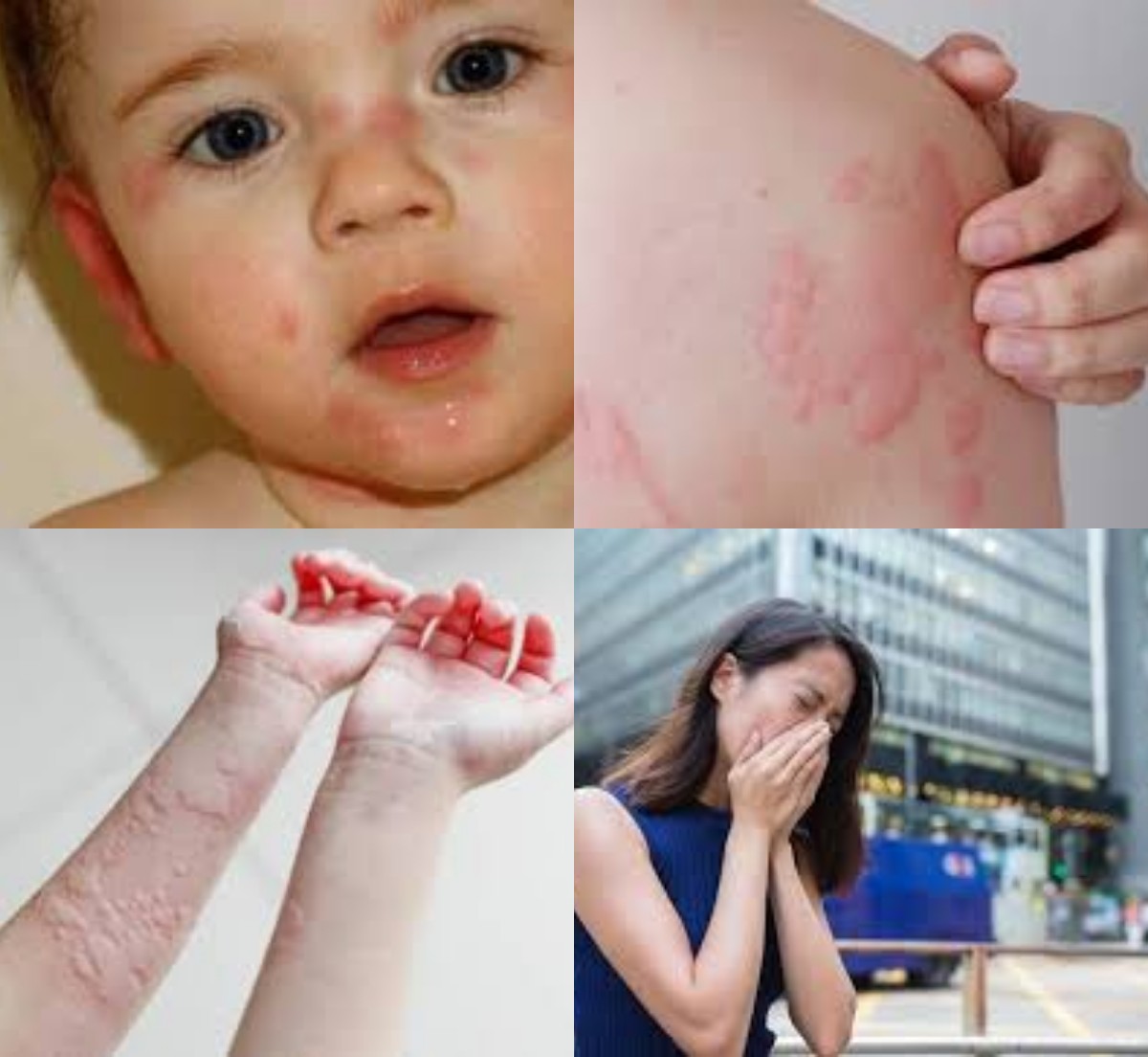 Mencegah Alergi Dingin dan Debu: Kenali Gejala, Faktor Pemicu, dan Langkah Pencegahan Sejak Dini