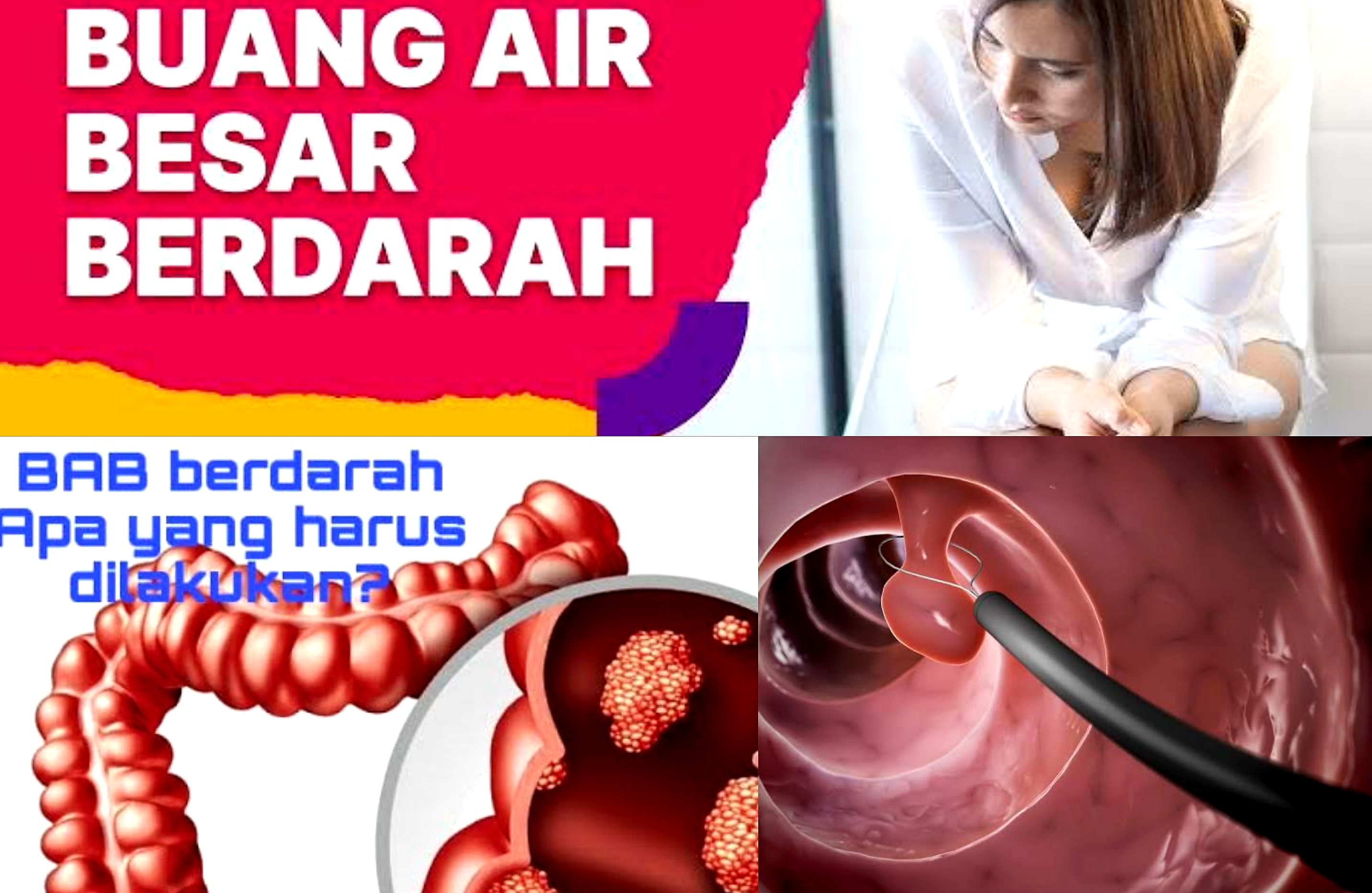 Kenali Penyebab dan Cara Mengatasi BAB Berdarah