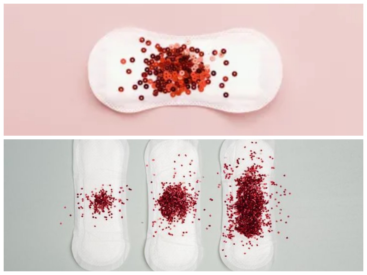  Darah Haid Hitam? Ini 9 Alasan yang Perlu Kamu Tahu!