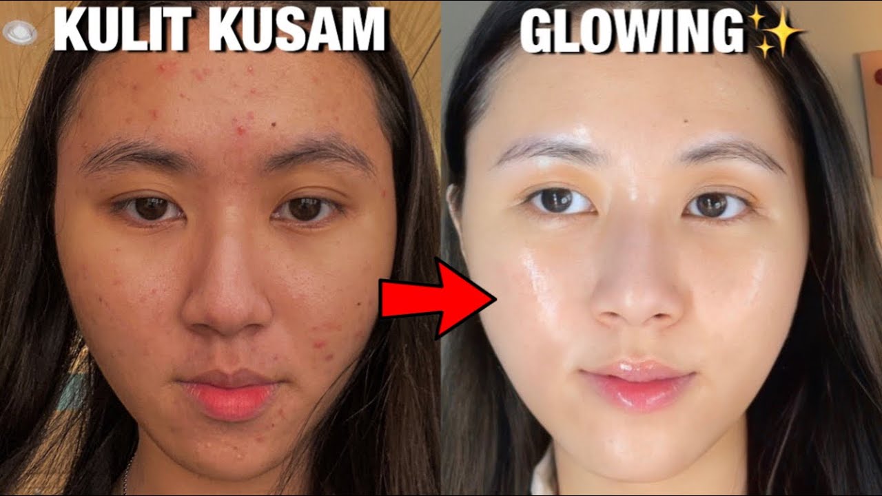 Kulit Kusam? Yuk Atasi dengan 5 Tips Mudah Ini!