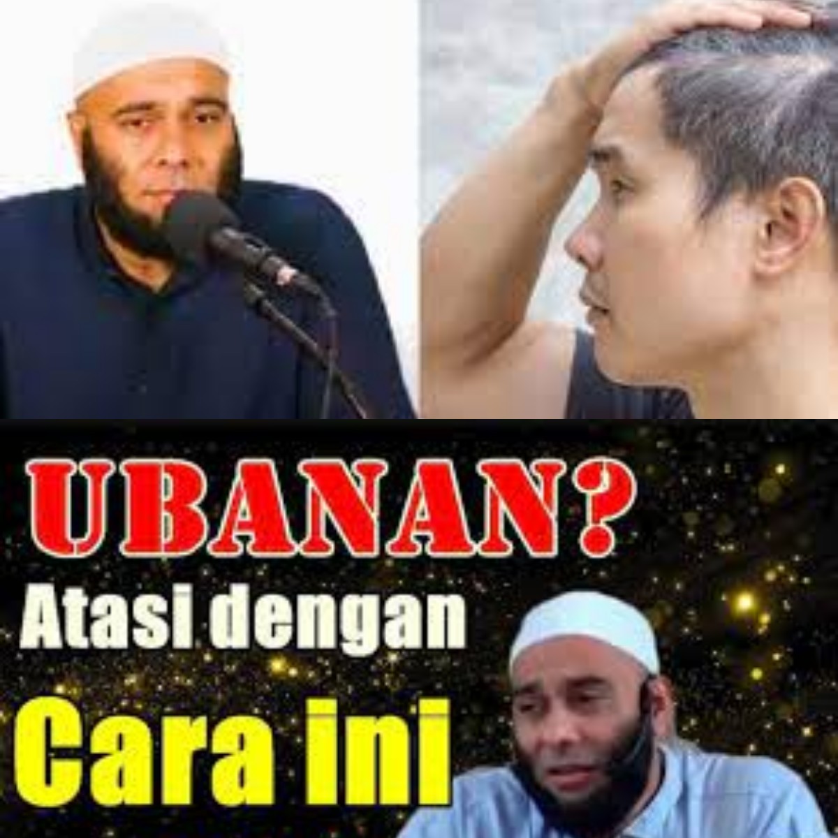 Hanya dengan Bahan Dapur! Inilah Tips Ala dr Zaidur Akbar untuk Menghitamkan Rambut 