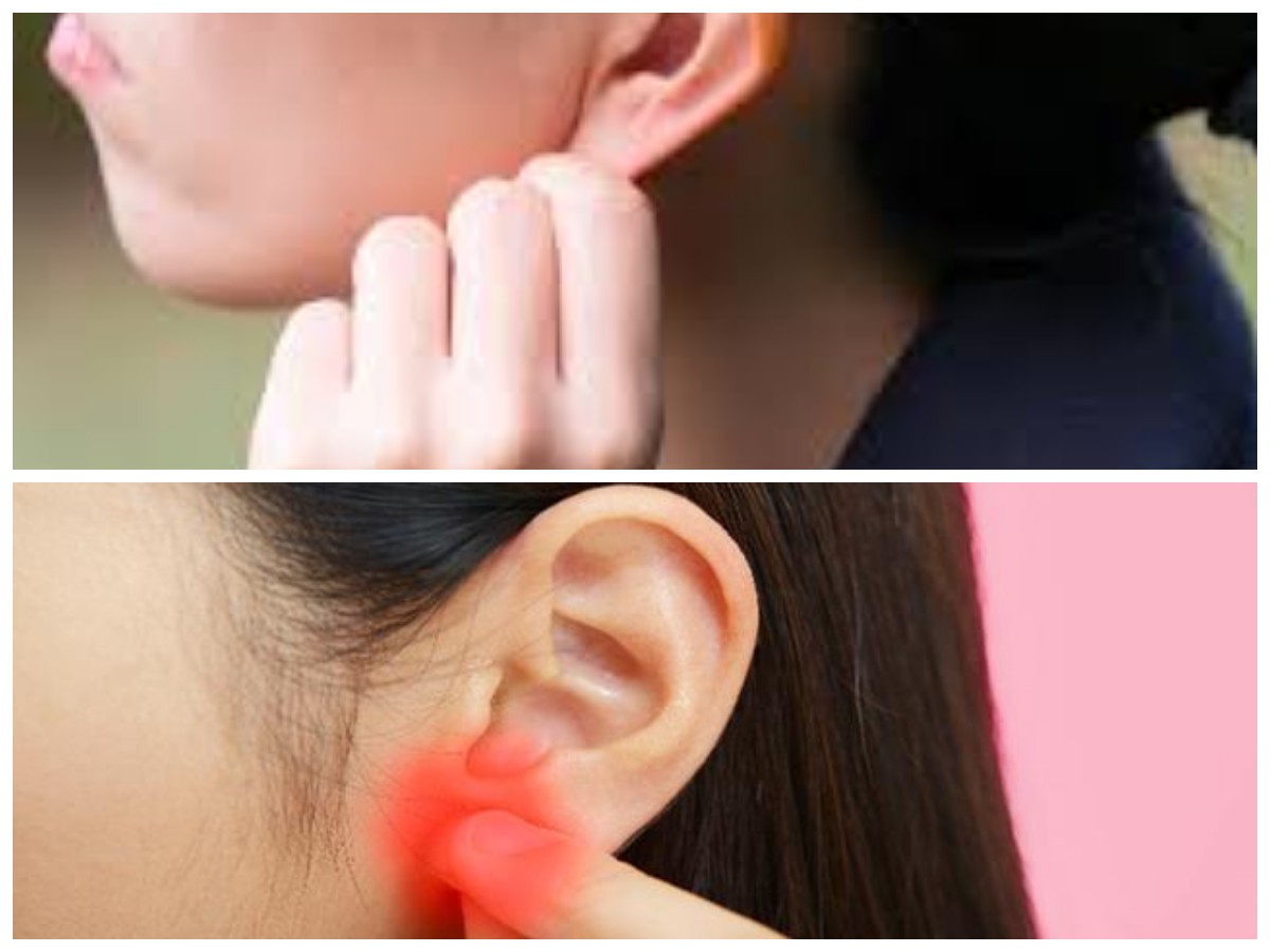 Tips Efektif Mengatasi Benjolan pada Daun Telinga Agar Tidak Menyakitkan