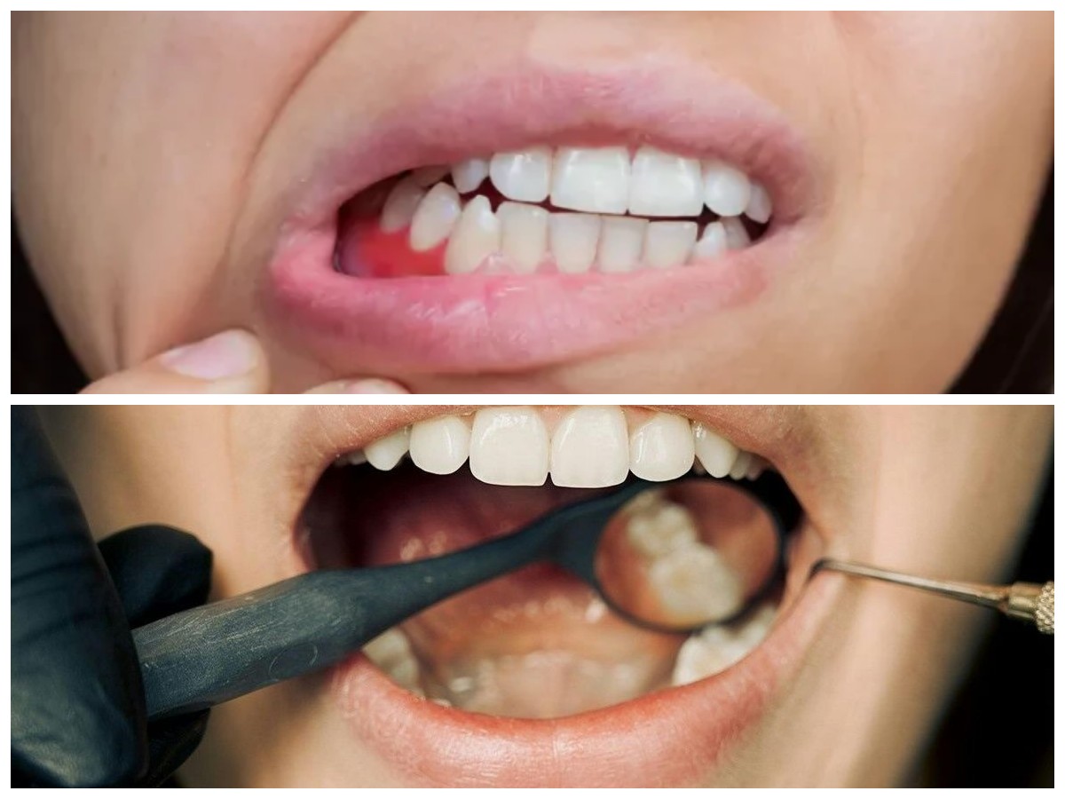 Gusi Bengkak & Berdarah? Coba Cara Praktis Ini untuk Meredakannya!