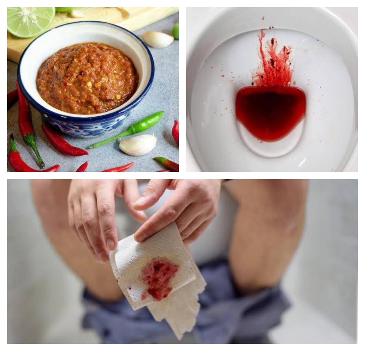 5 Jenis Makanan yang Dapat Memicu BAB Berdarah, Kenali Penyebabnya