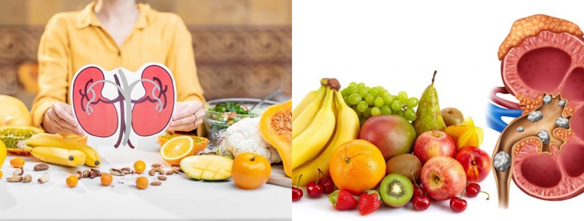 Waspada! Makanan yang Bisa Membebani Kerja Ginjal Anda dan Menurunkan Kesehatannya