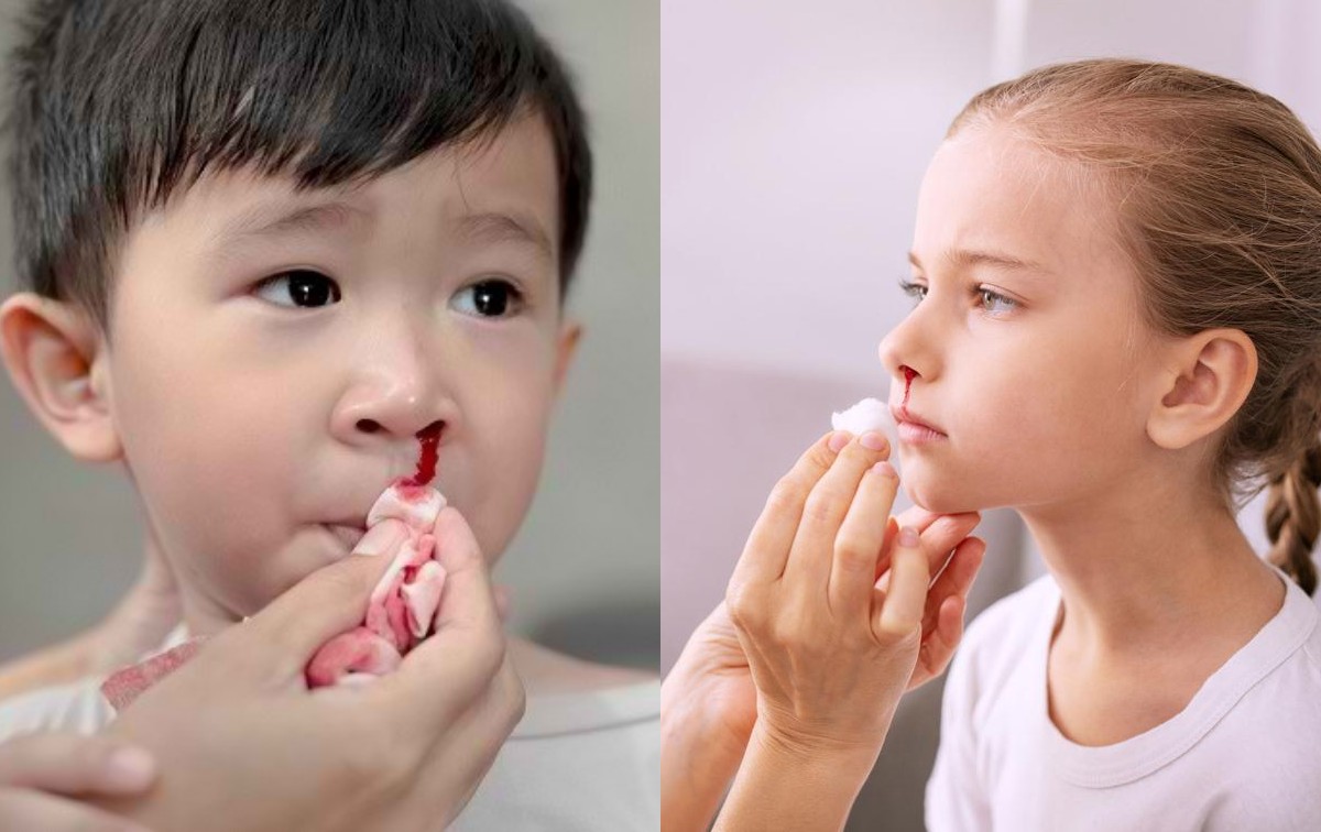 Ada Beberapa Penyebab Mimisan pada Anak Saat Tidur, Ketahui Penyebab Mimisan pada Anak saat Tidur!