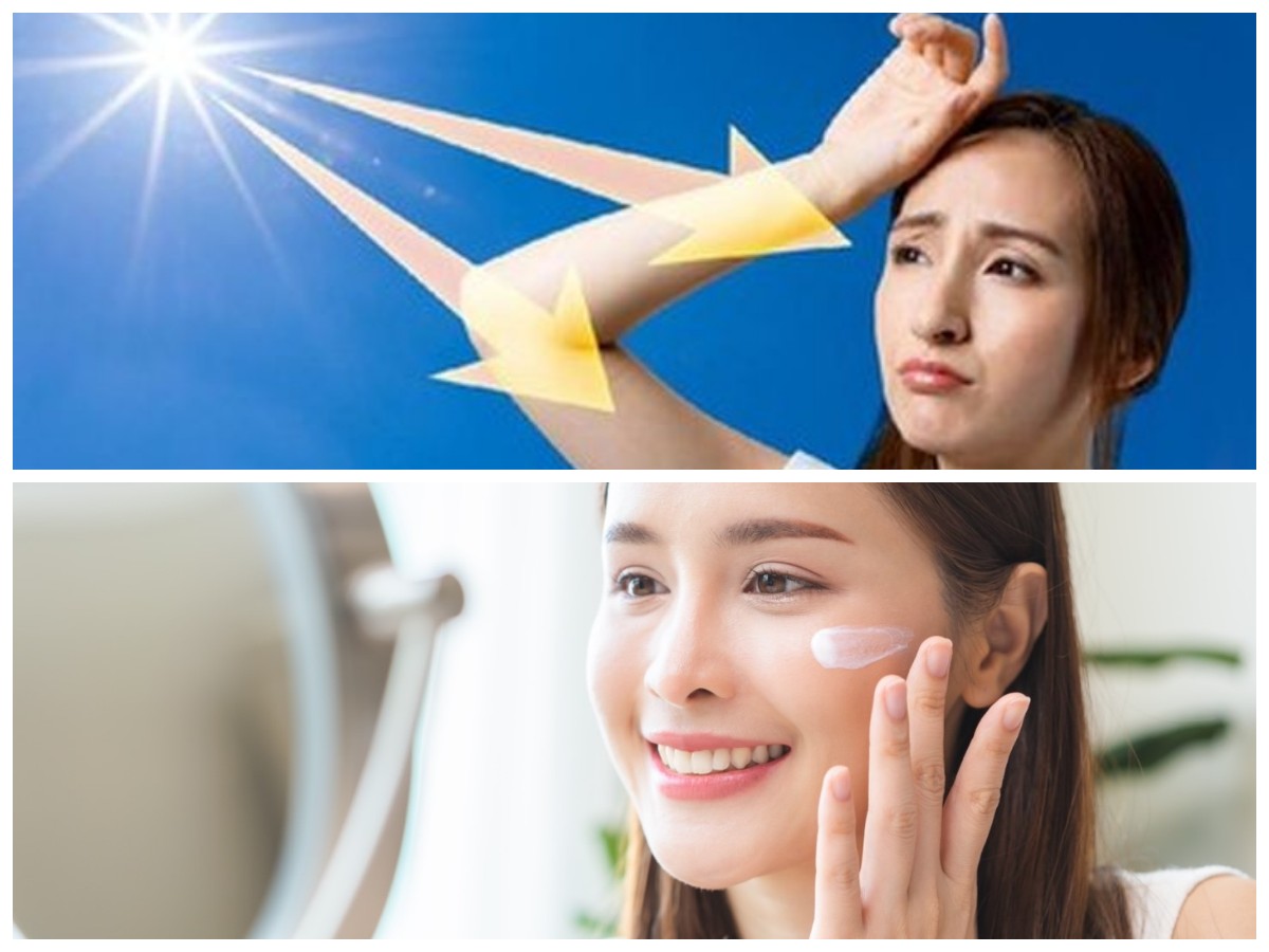 Sinar UV Bisa Picu Penyakit Serius, Ini Tips Ampuh untuk Mencegahnya