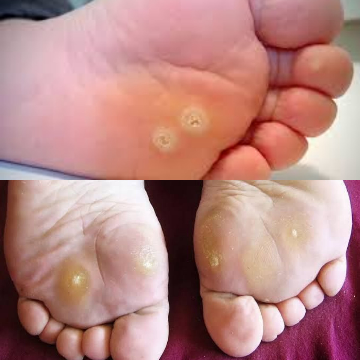 6 Penyebab Mata Ikan dan Cara Mengatasinya yang Efektif!