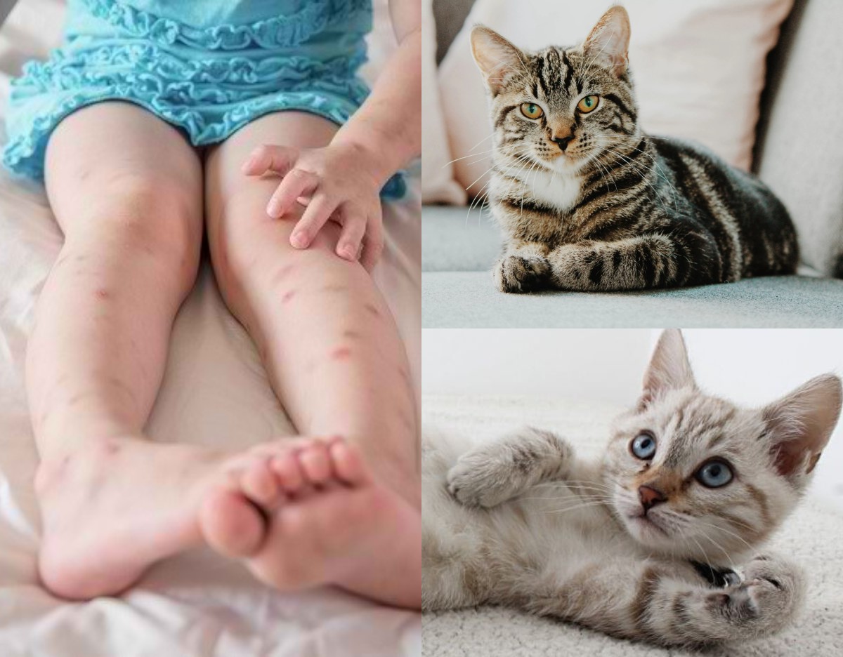 Kutu Kucing sering Ditemui di Bulu-bulu atau Kulit Kucing, Ini Ciri-Ciri Gigitan Kutu Kucing pada Manusia!