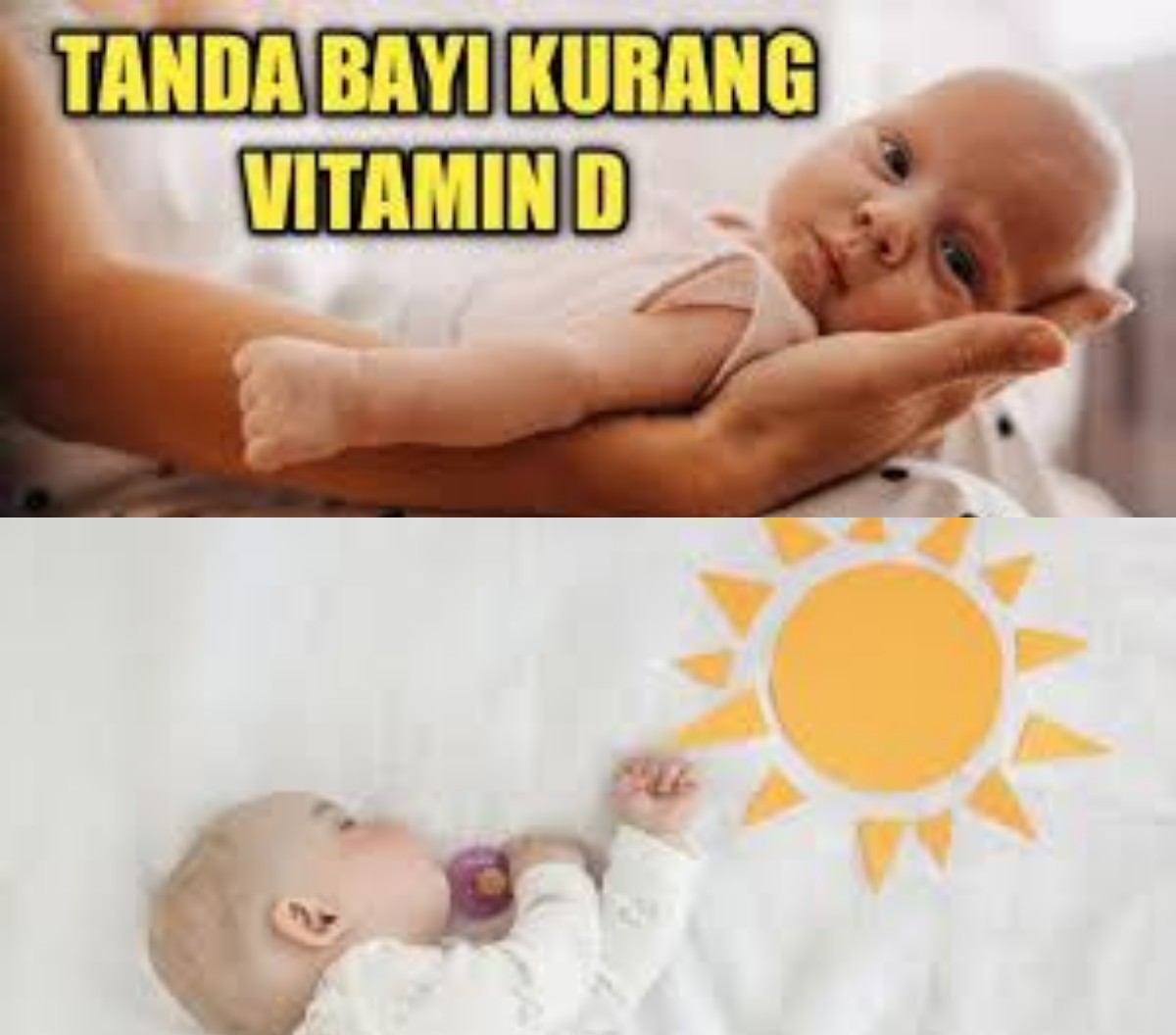 Tanda Bayi Kekurangan Vitamin D dan Cara Mengatasinya untuk Pertumbuhan Optimal
