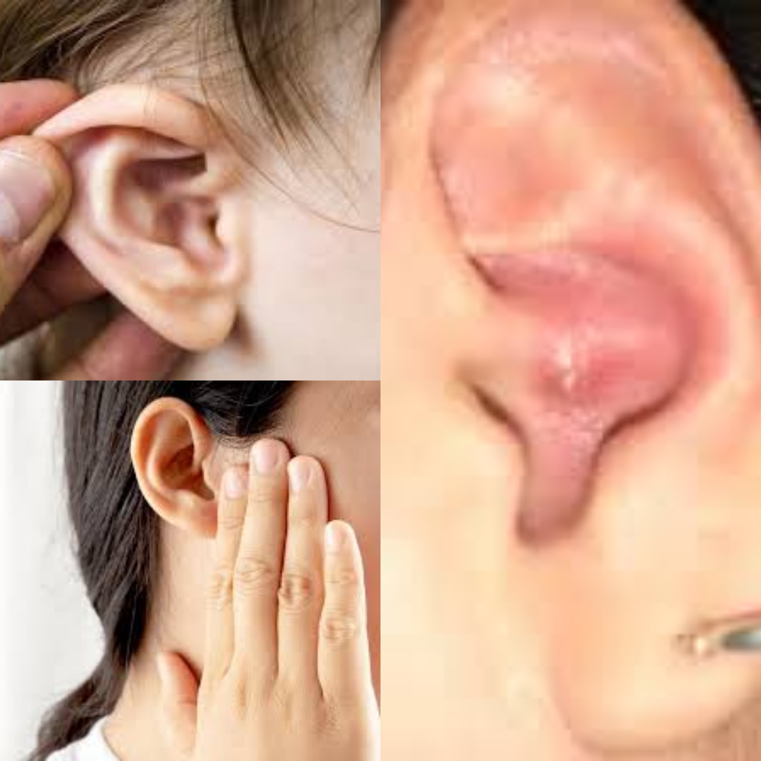 Mirip Jerawat tapi Bukan! Waspadai Benjolan di Telinga dan Cara Mengobatinya”