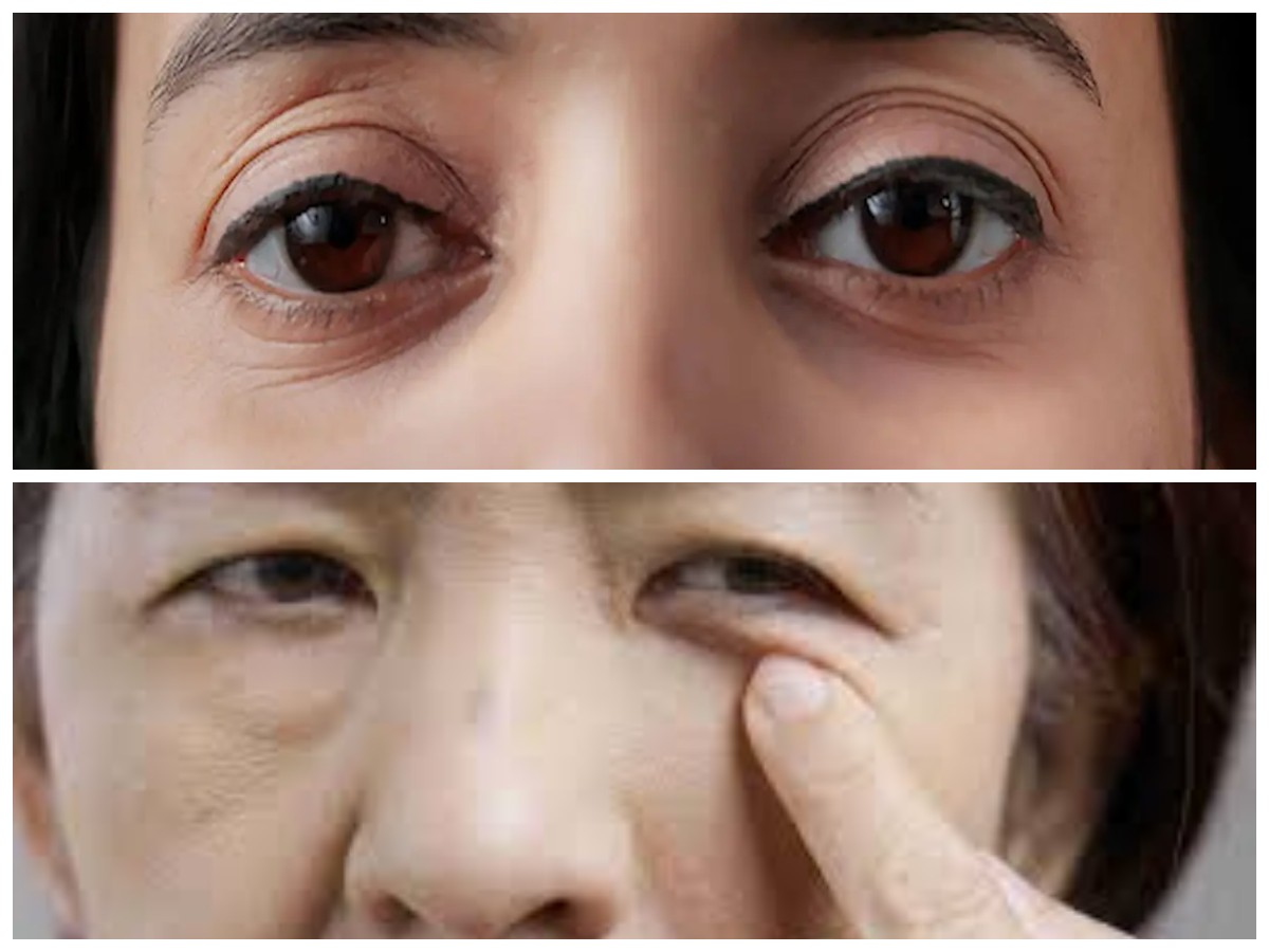 Tips Ampuh Mengurangi Mata Sayu dan Membuat Mata Tampak Segar