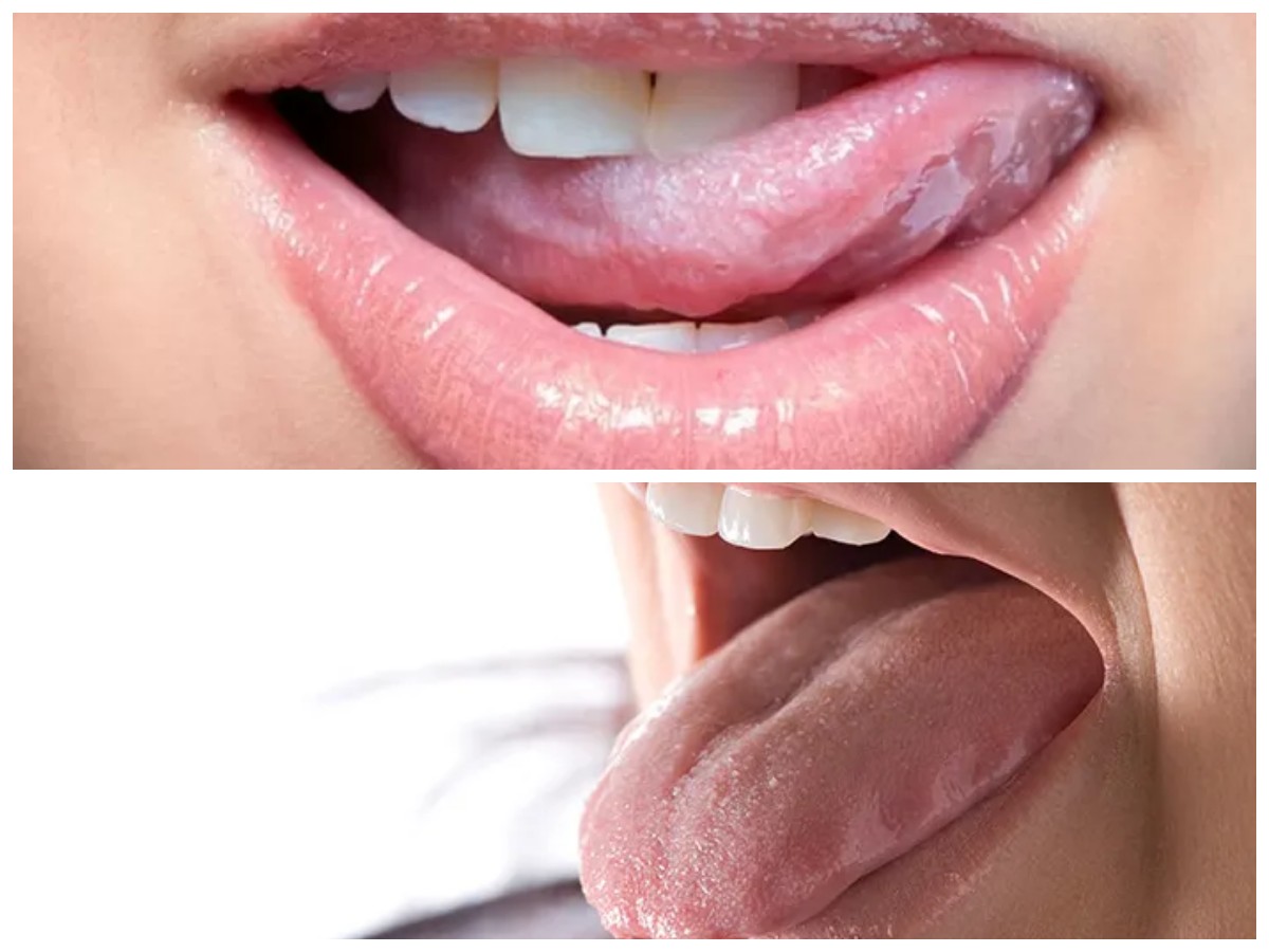 Mulut Terasa Manis: Waspadai Penyebab Medis dan Tips Mengatasinya Secara Aman