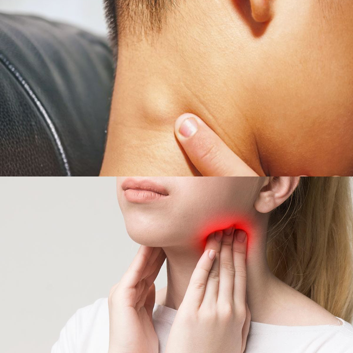 Infeksi kelenjar getah bening,Ini Dia Penyebabnya Simak!