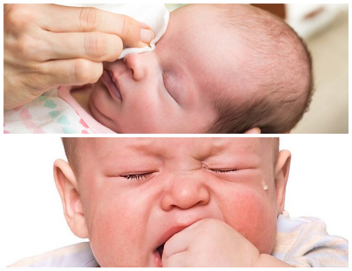 Solusi Tepat untuk Mata Bayi Belek: Cara Mengobati dan Menanganinya