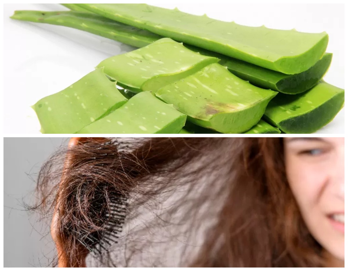 Solusi Alami: 5 Cara Mengatasi Rambut Rontok yang Ampuh