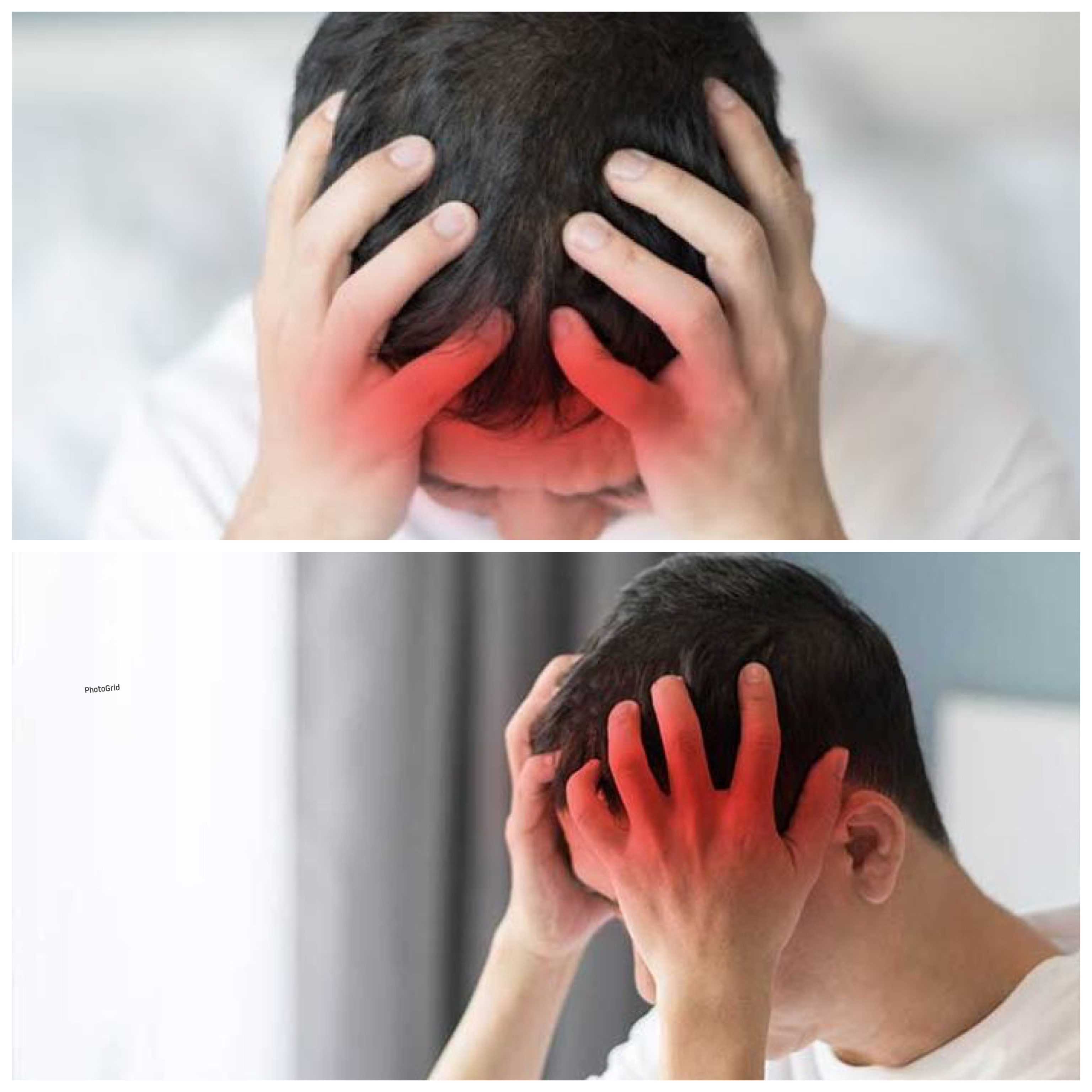 Tips Mengatasi Sakit Kepala akibat Kolesterol Tinggi: Cara Alami dan Medis untuk Meredakannya!