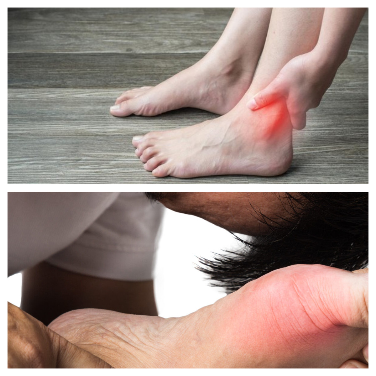 Asam Urat: Penyebab, Gejala, dan Cara Mengelola dengan Benar, Yuk Simak!