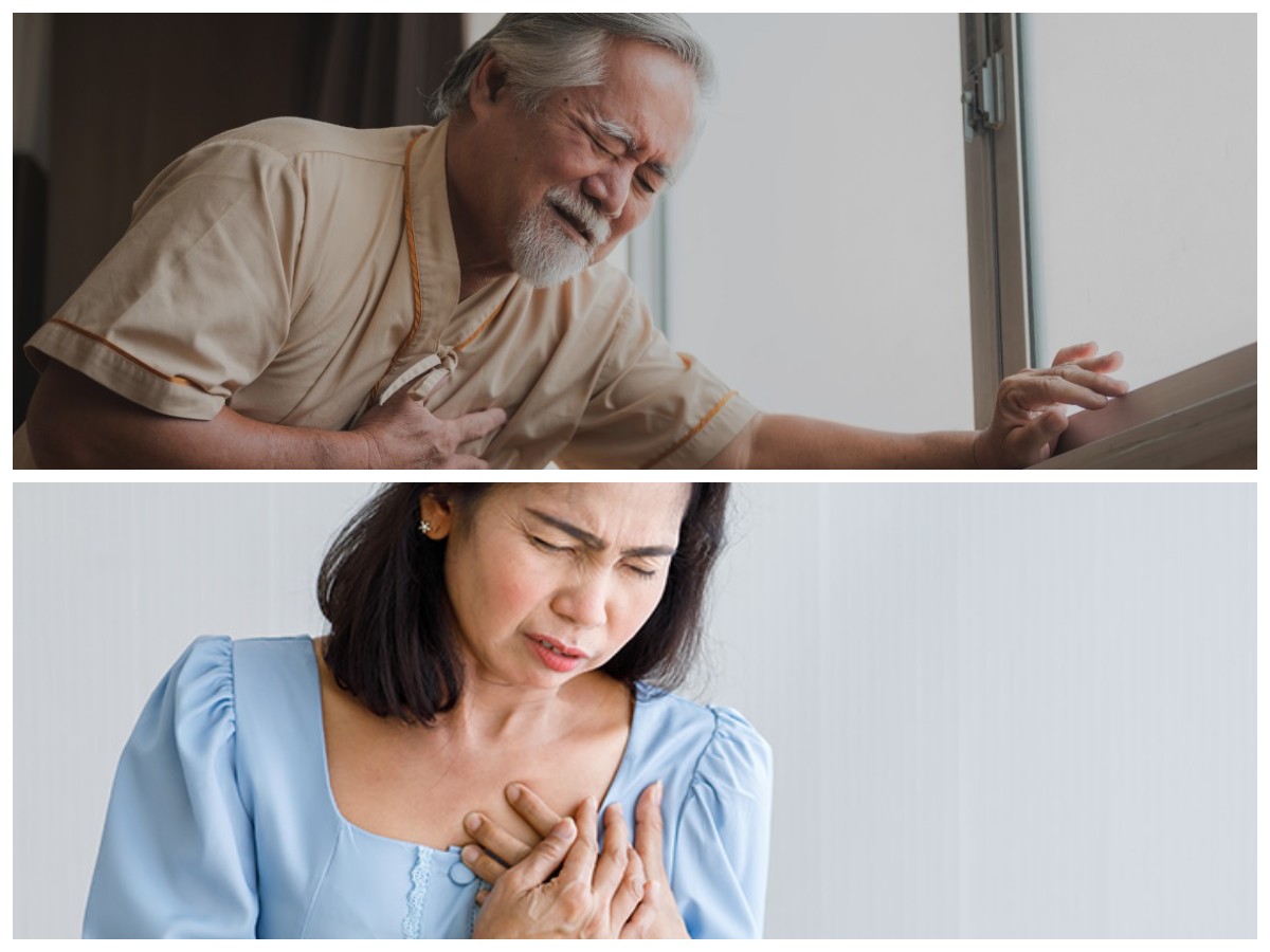 Waspadai Penyakit Jantung Koroner! Penyebab, Ciri-Ciri, dan Pilihan Pengobatan yang Tepat