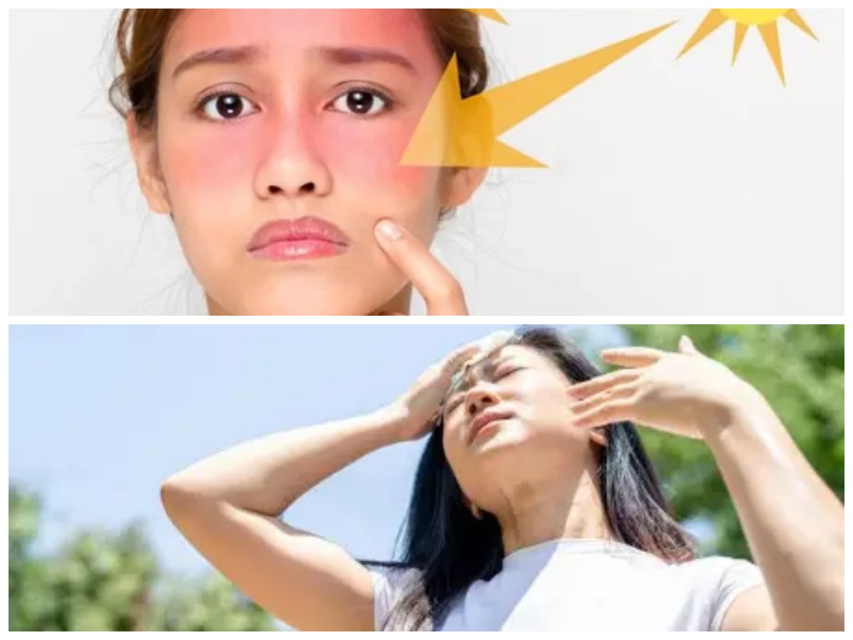 Waspada Dampak Sinar UV: Kenali Risiko Kesehatan dan Cara Melindungi Diri