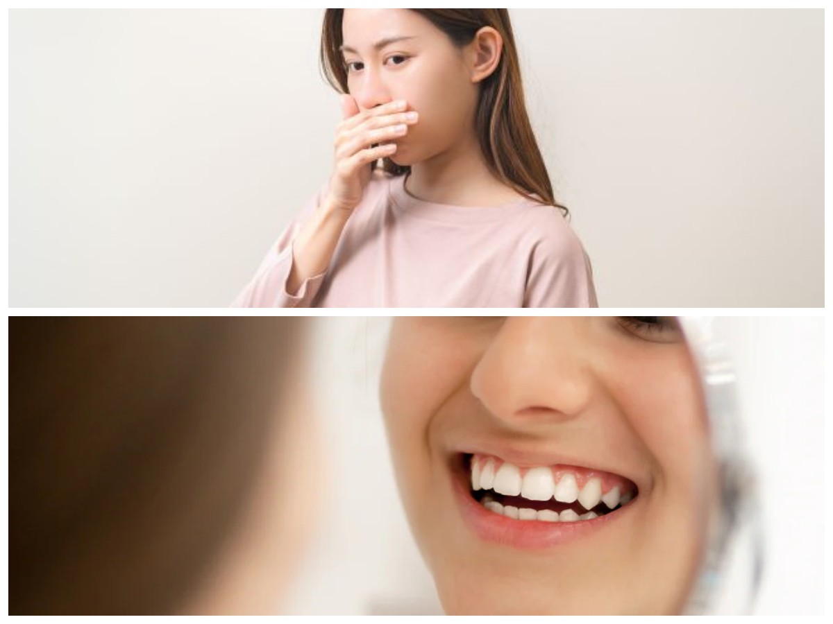 Rahasia Terhindar dari Bau Mulut: Tips Efektif yang Wajib Dicoba!