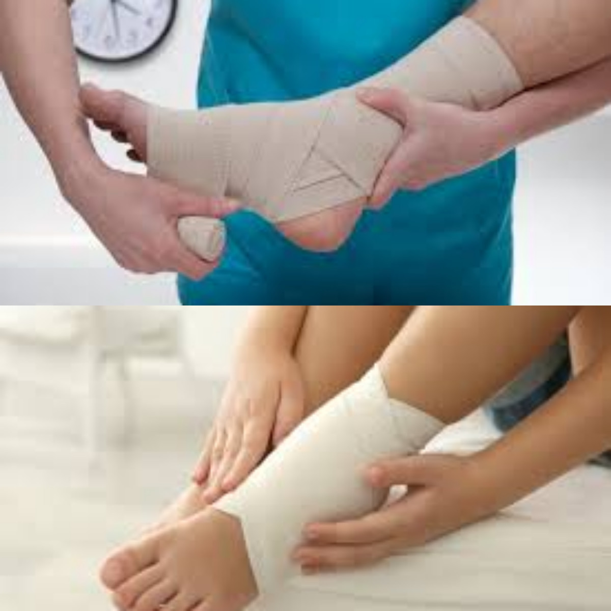 7 Cara Mengatasi Kaki Keseleo yang Bisa Dilakukan di Rumah!  